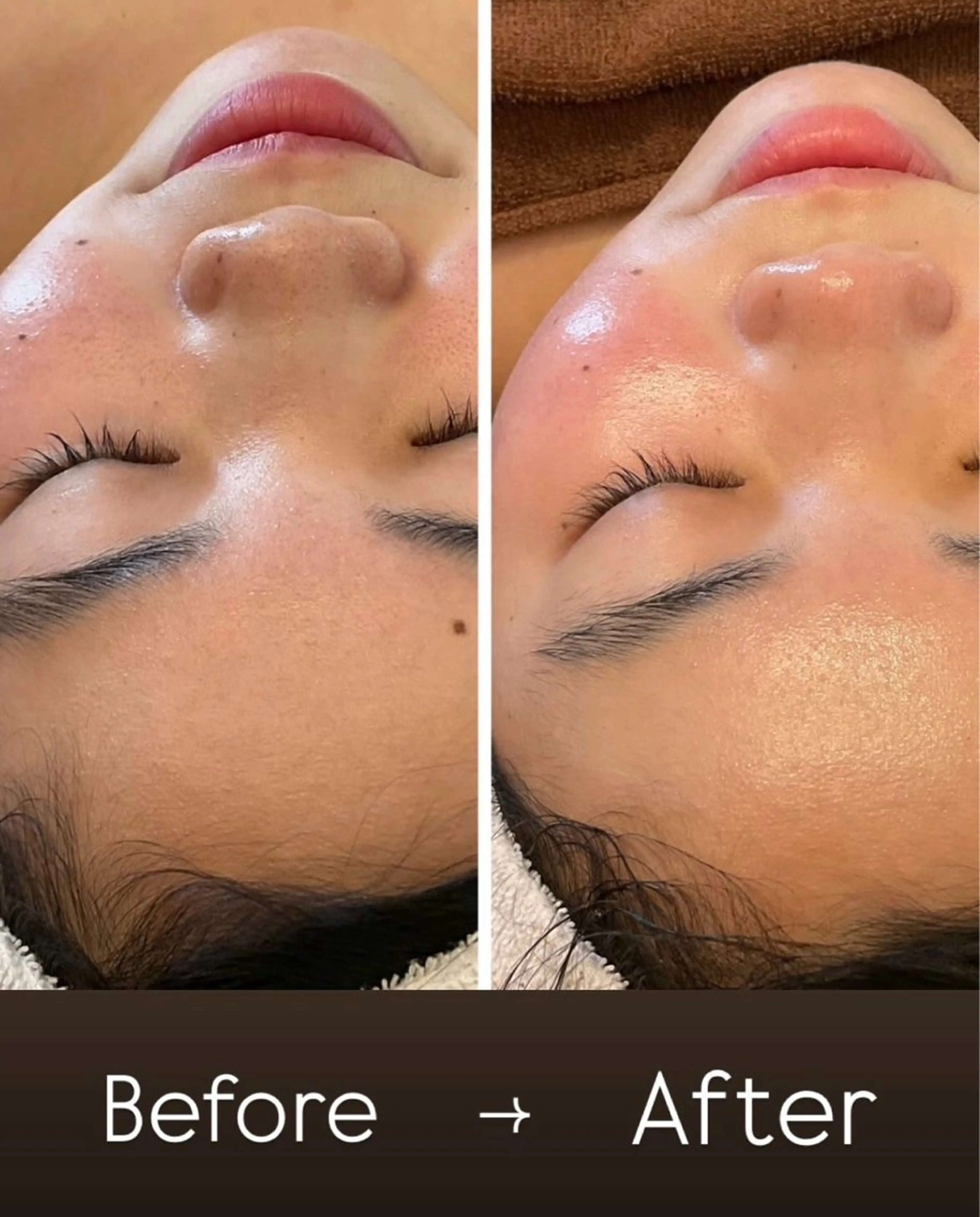 ナルシストータルビューティーサロン所属・友森 千香のエステ・リラクイメージ