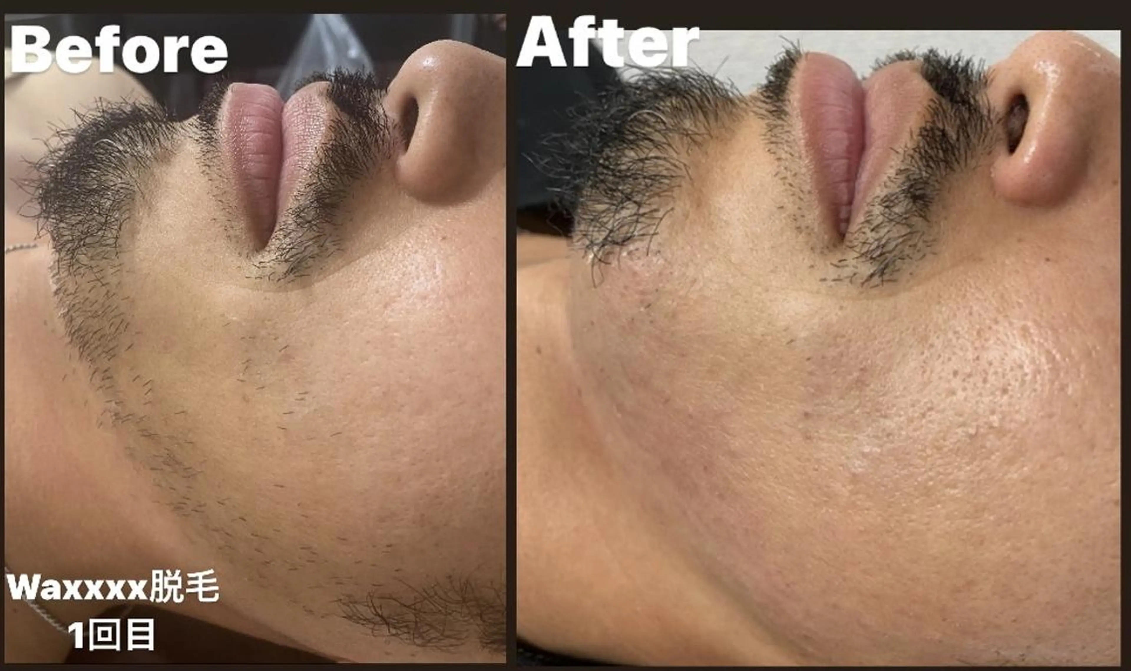 メンズ 脱毛 Epina 千葉店 【エピナ】のエステ・リラクイメージ