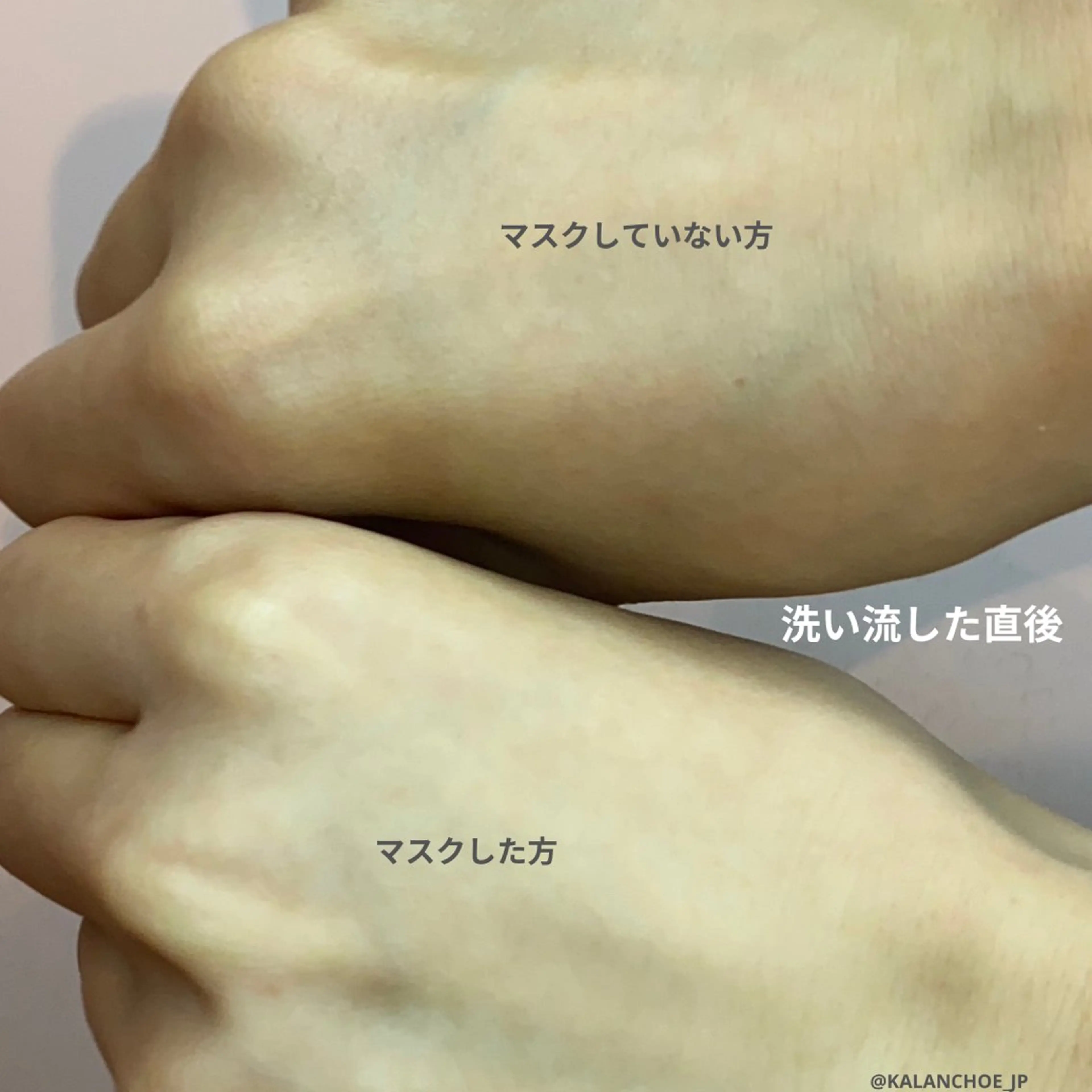 肌質改善 KALANCHOEのエステ・リラクイメージ