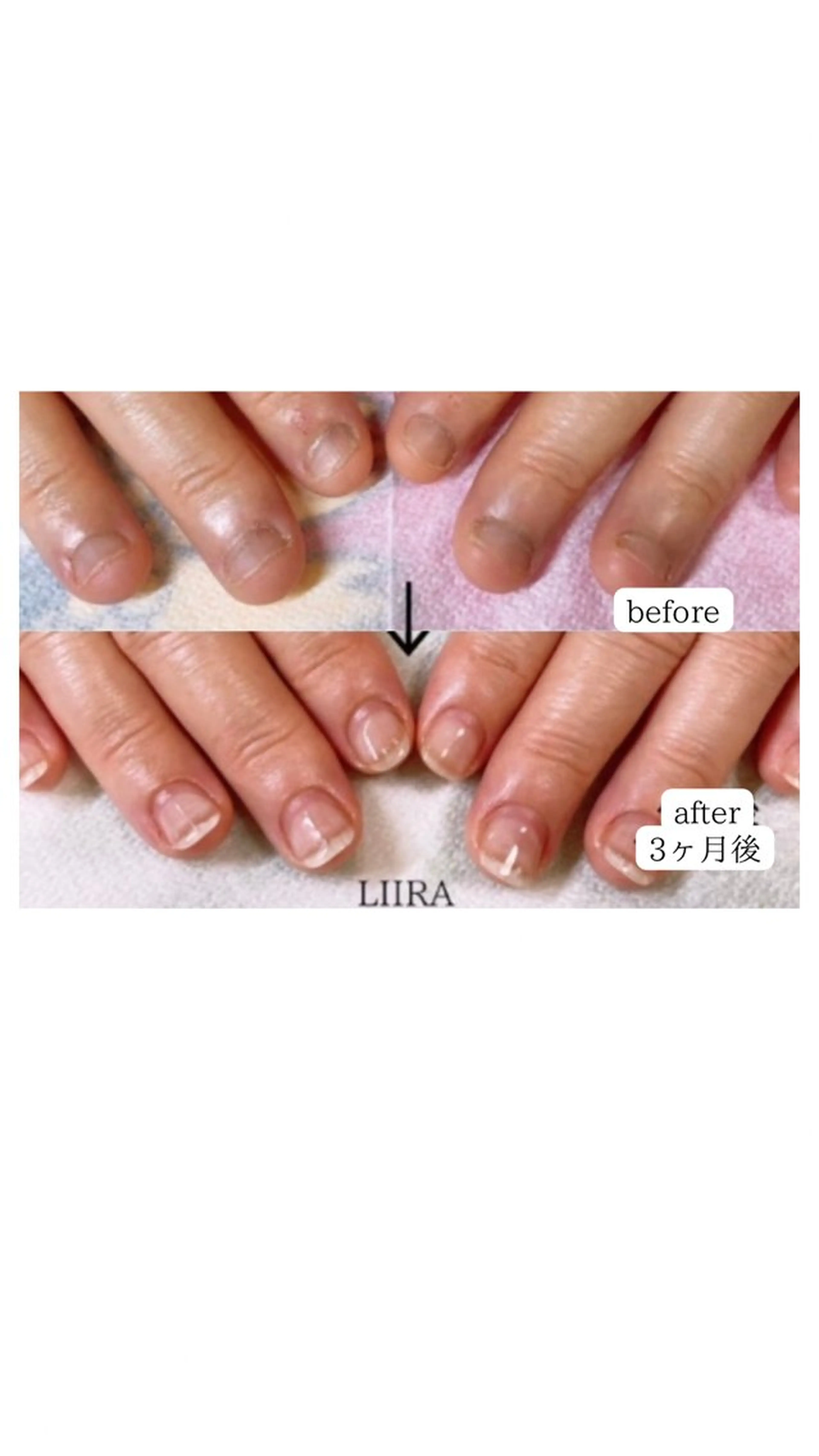 ネイル ハンドネイル LIIRA(西船)/ やまださおりのネイルデザイン