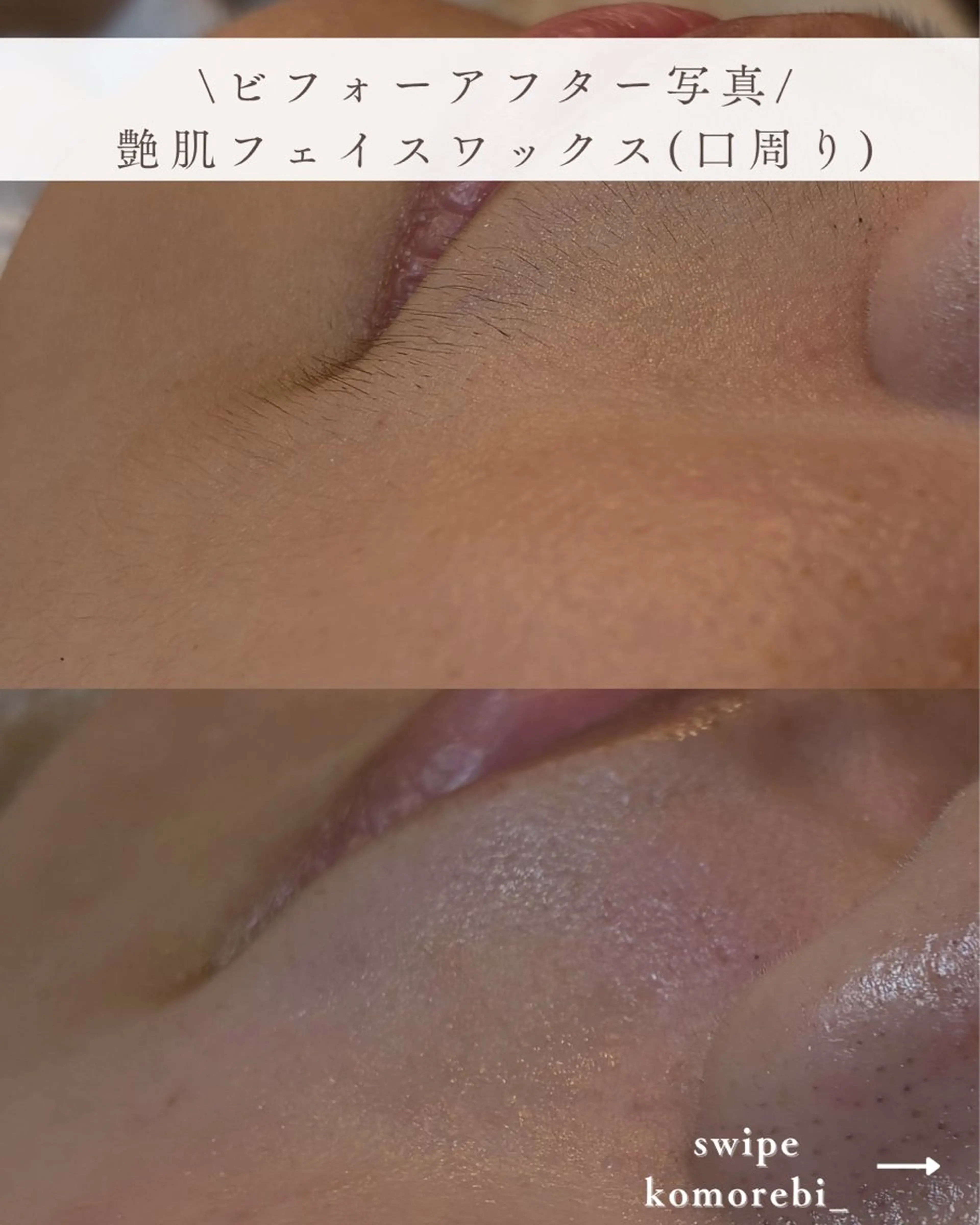 Erika komorebi_のエステ・リラクイメージ