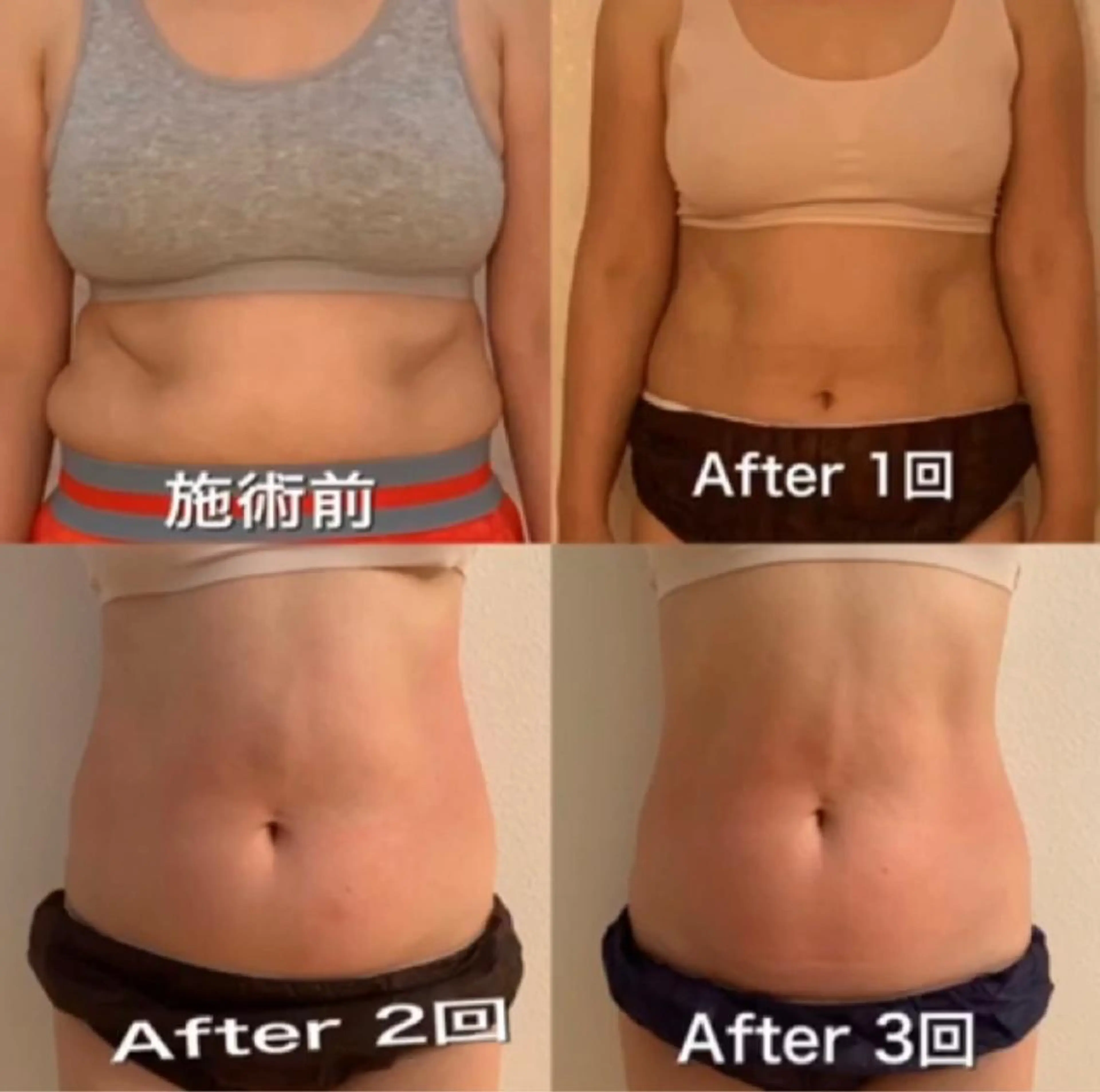 エステ リラク 【ハイパーナイフ痩身&小顔コルギ&ハーブピーリング】K-Beauty　東新宿所属・kーbeauty痩身 フェイシャルのエステ・リラクイメージ