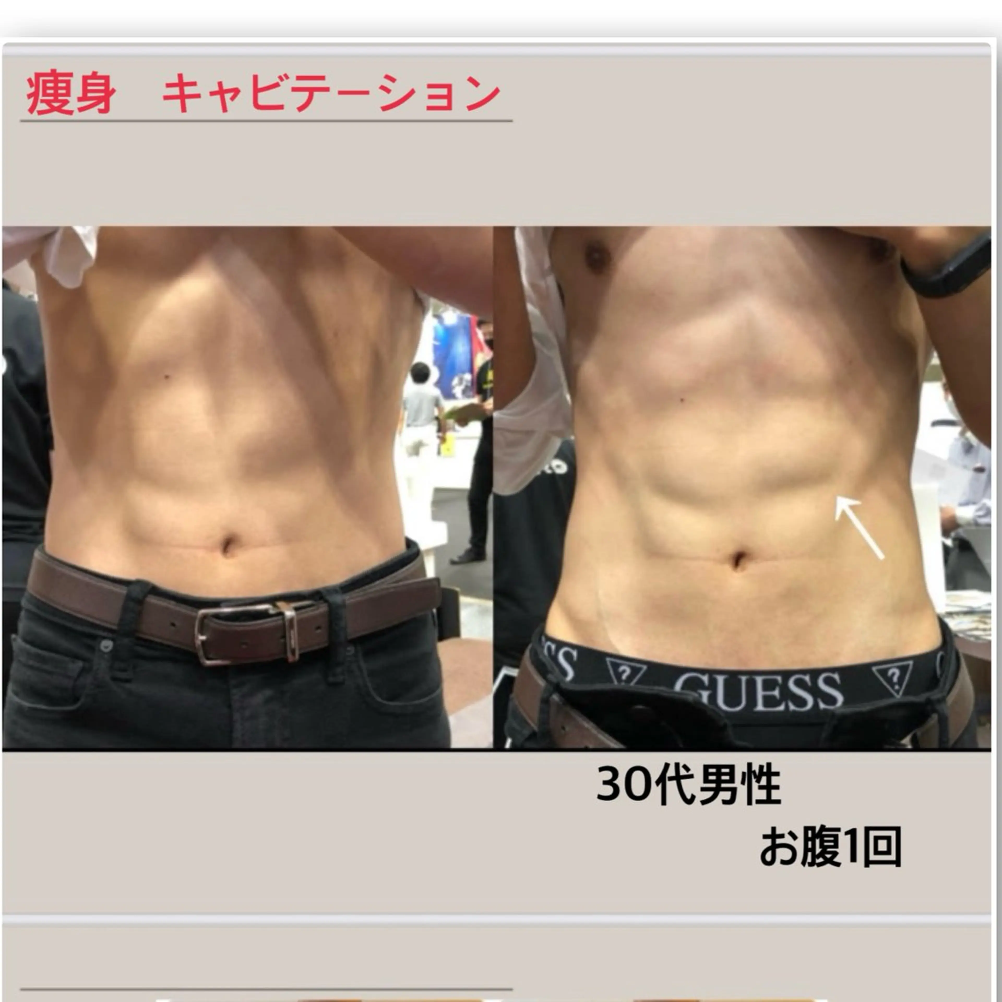 痩身60分3回コース😊39,600円✨1回あたり13,200円🔥4,500円お得🉐　その都度払いOK!の写真