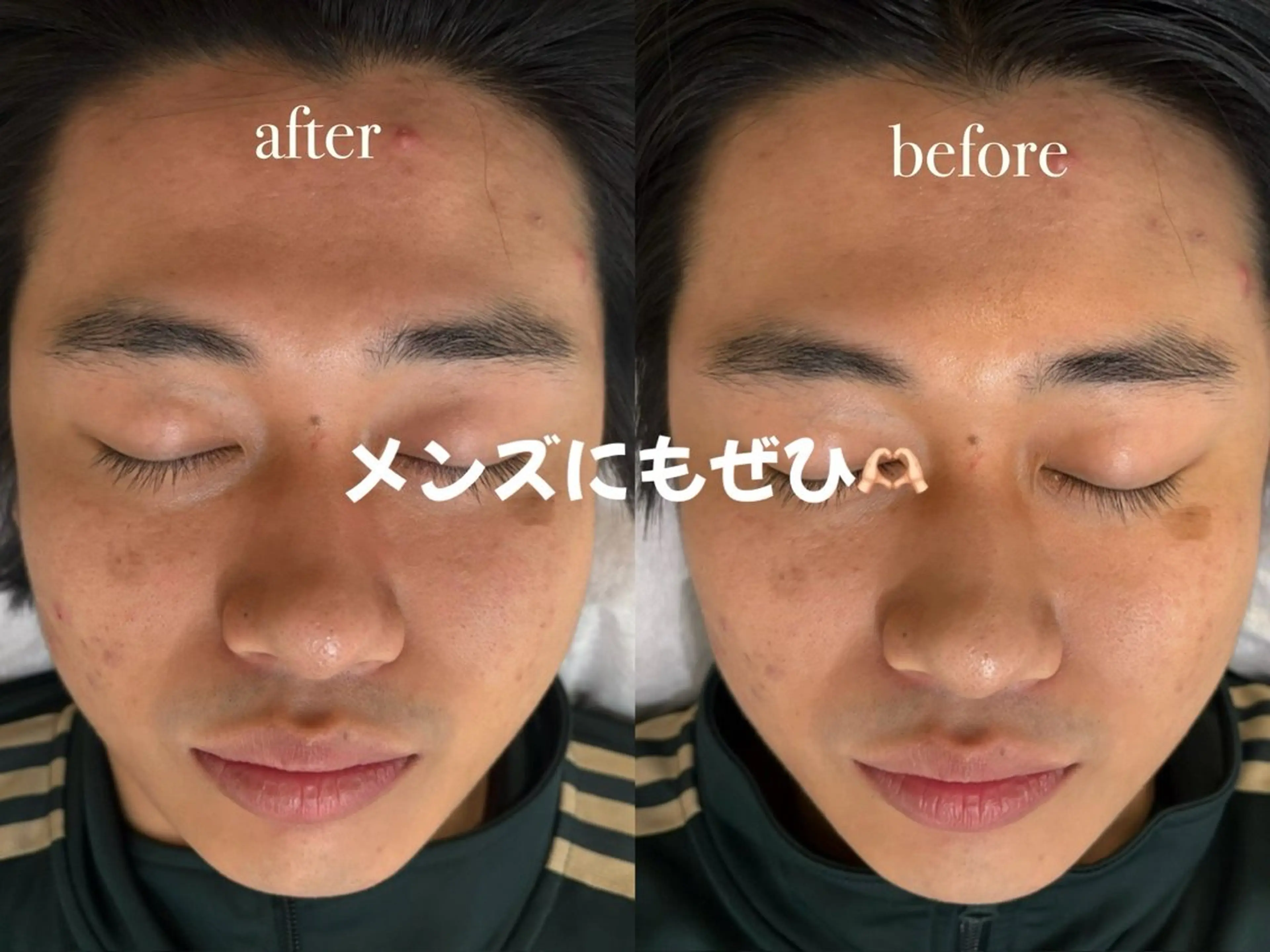 【メンズ時短コース】脳スッキリヘッド&側頭プラン🧠の写真