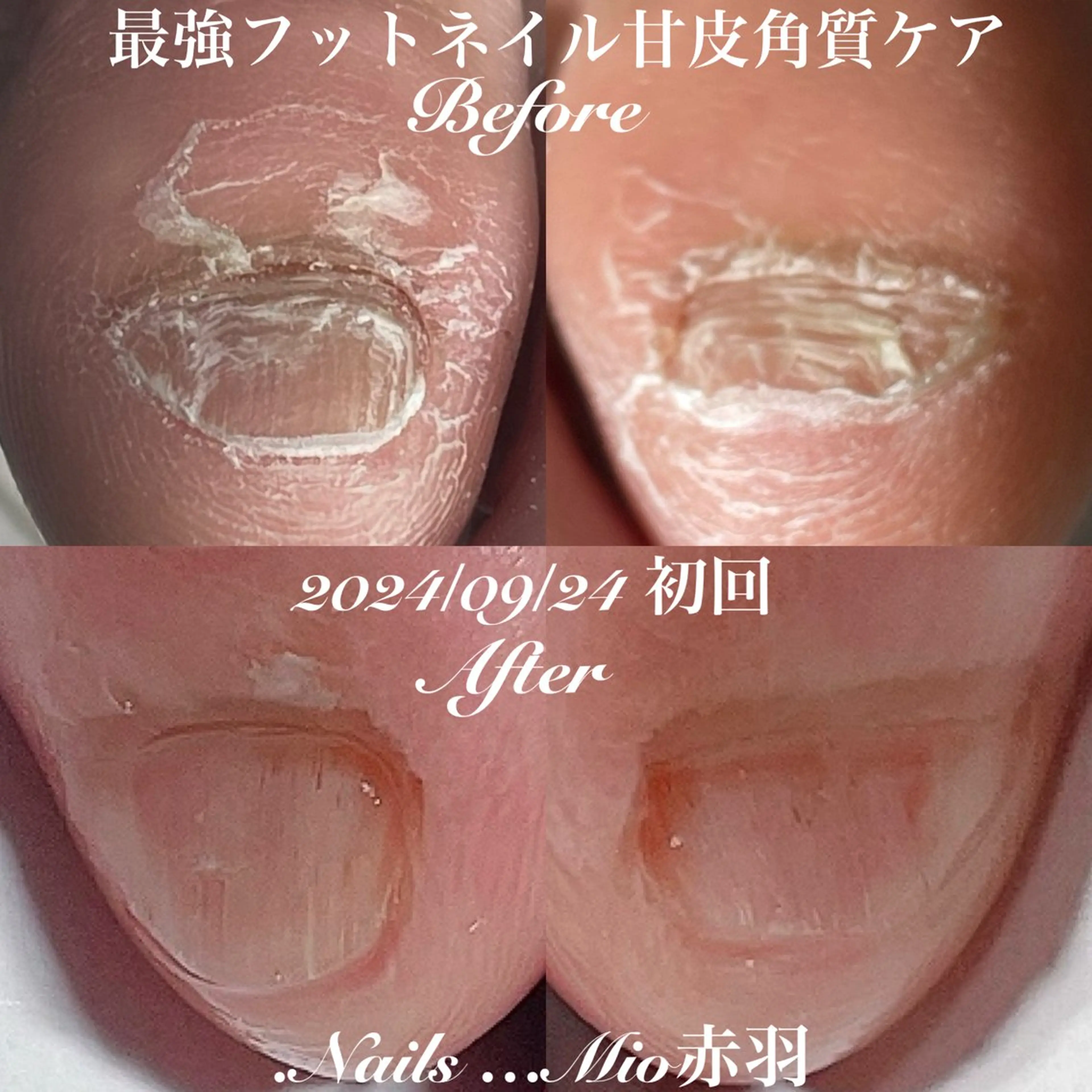 ネイル フットネイル .Nails Mio 赤羽西ネイルサロンのネイルデザイン