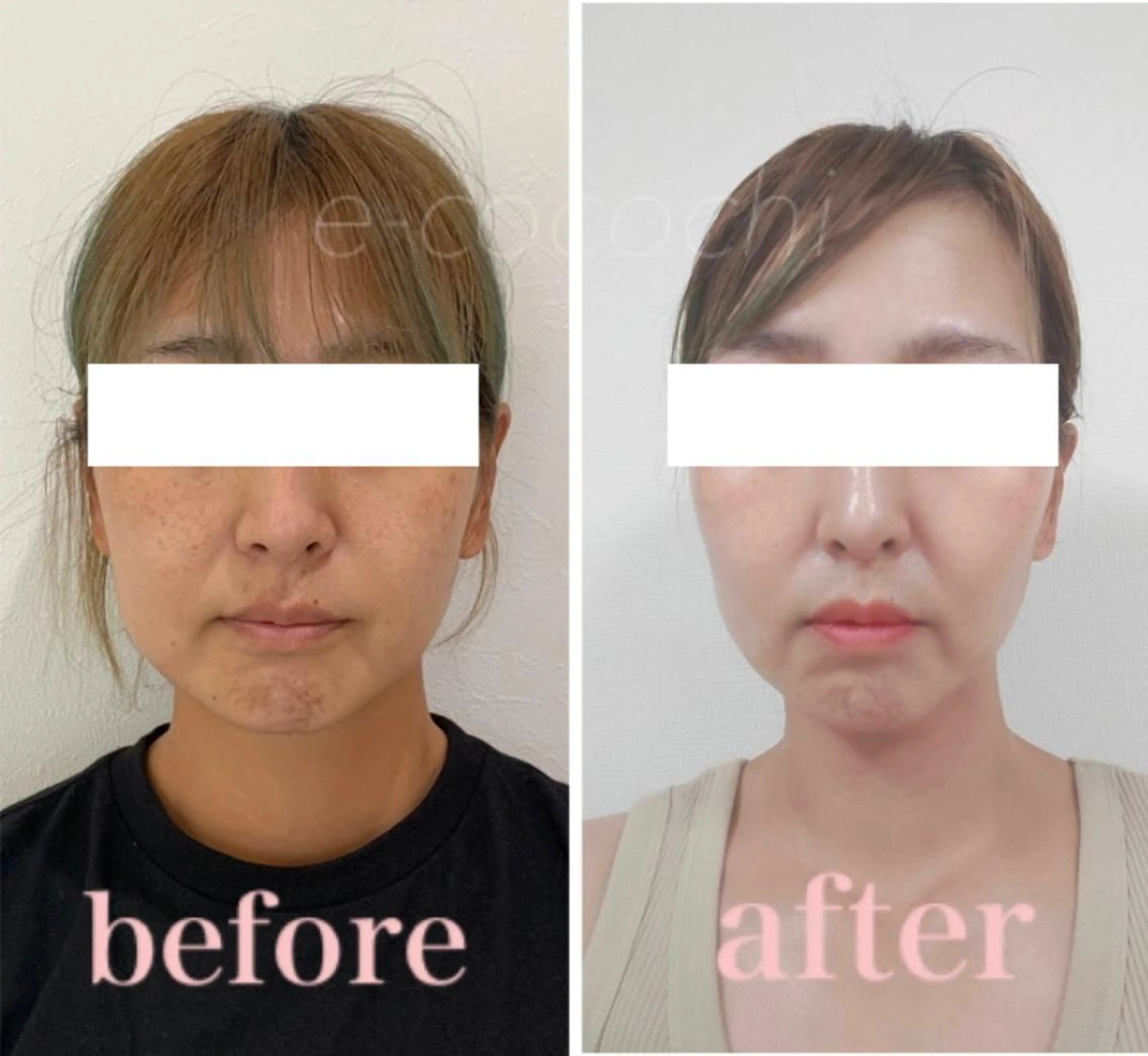 エステ リラク 小顔と ヘッドスパのお店のエステ・リラクイメージ