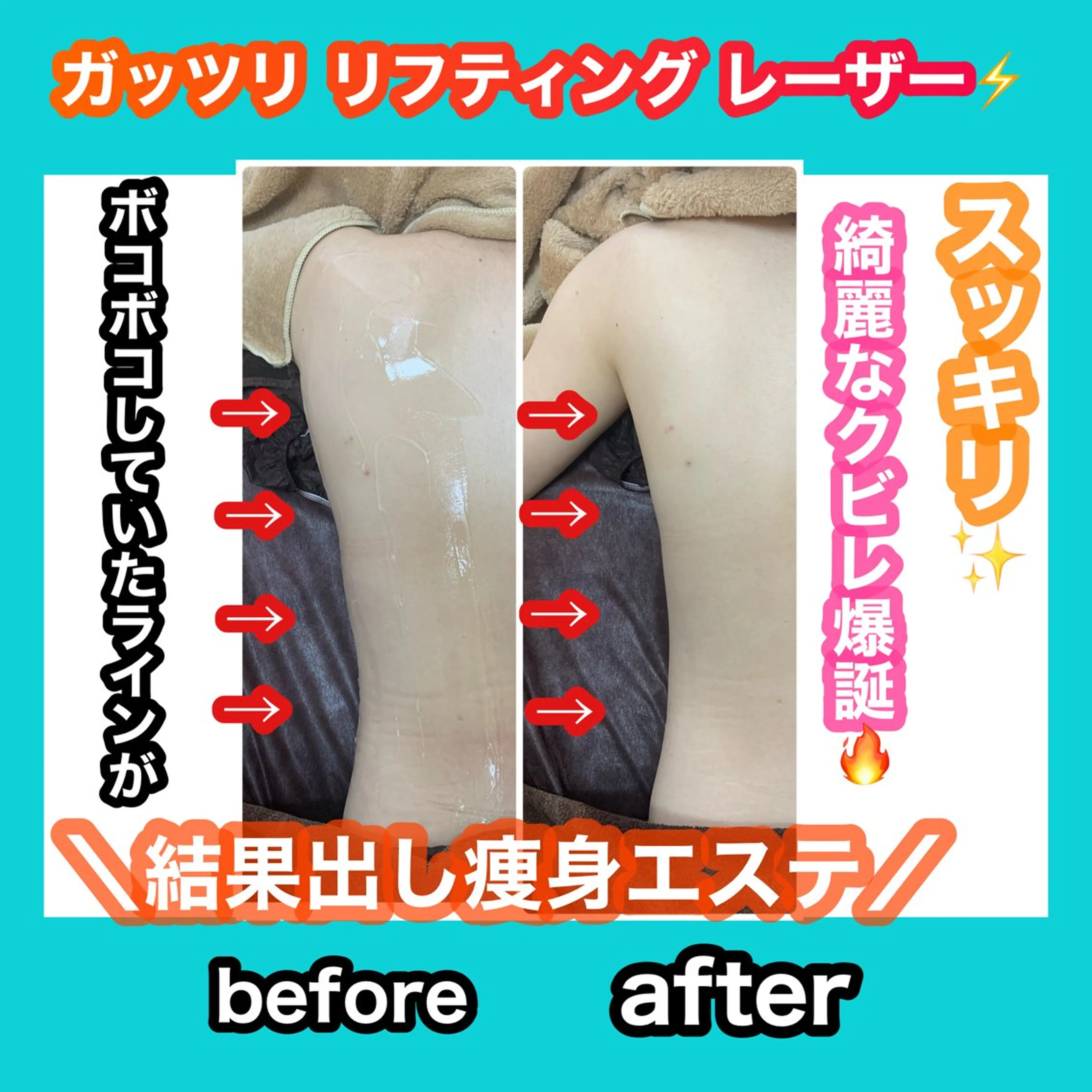 エステ 痩身/脱毛/ネイル HARUKAのエステ・リラクイメージ