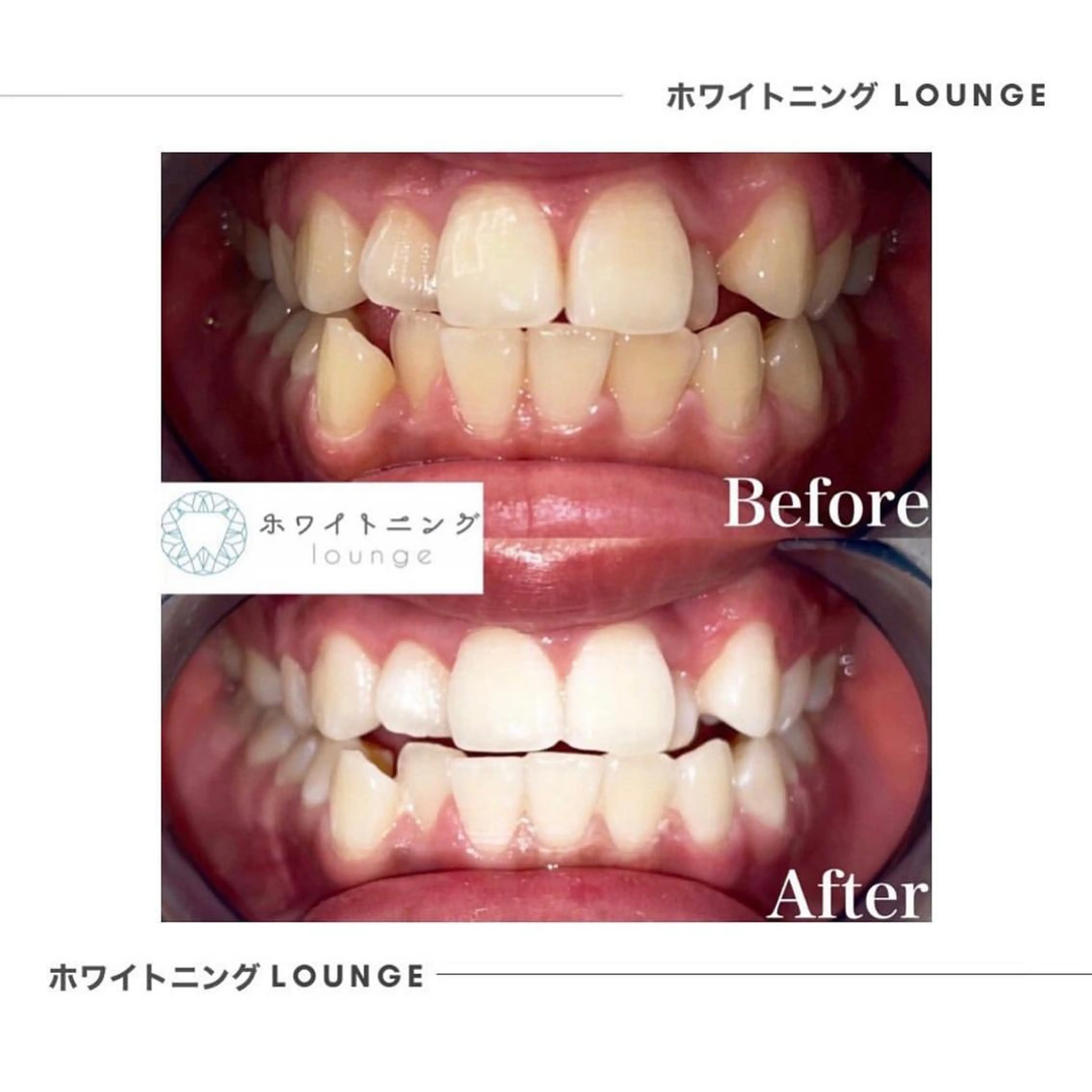 ホワイトニングラウンジ横須賀所属・ホワイトニング Lounge横須賀のその他イメージ