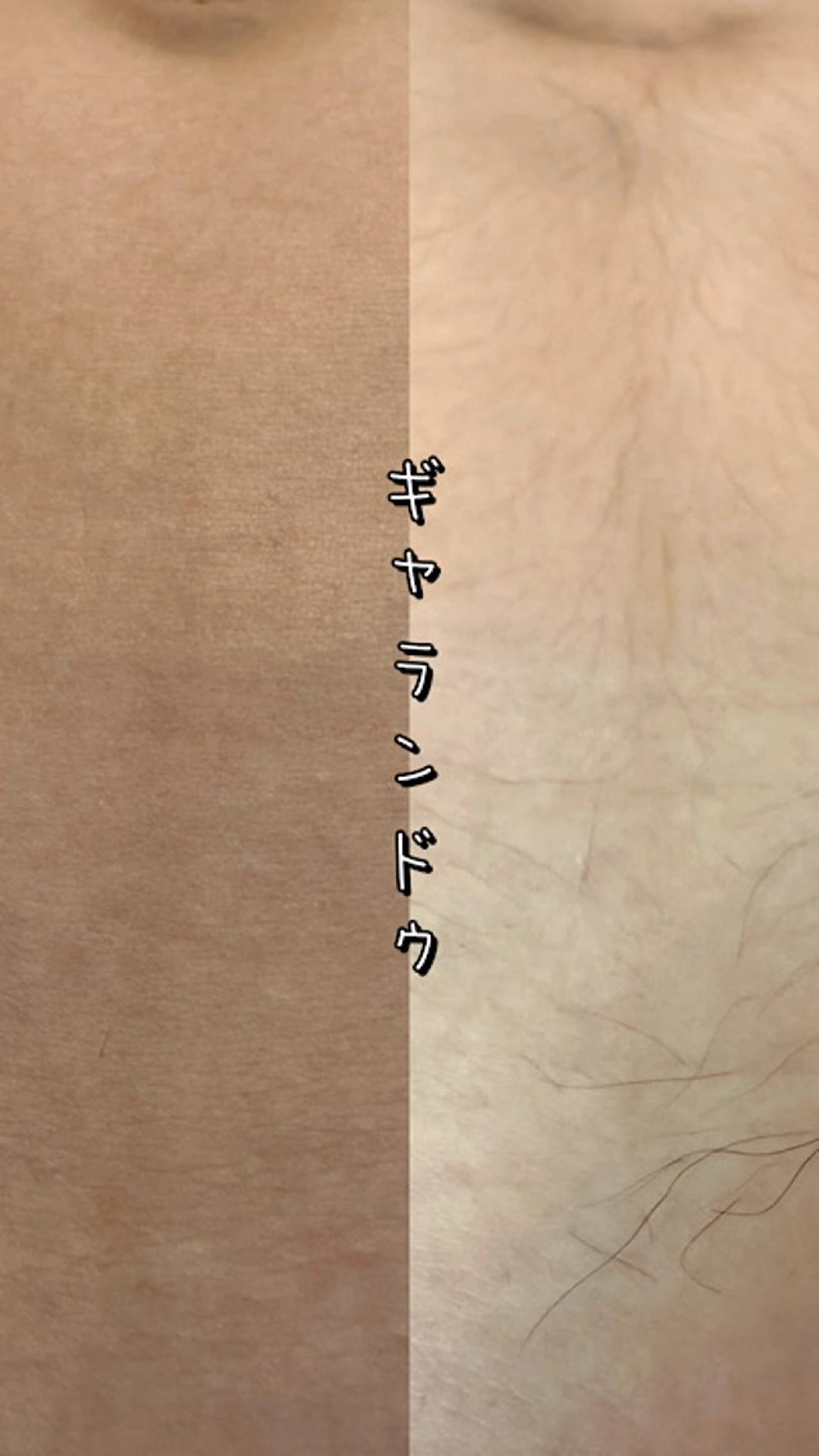 メンズ Hit. シュガーリング豊橋のエステ・リラクイメージ