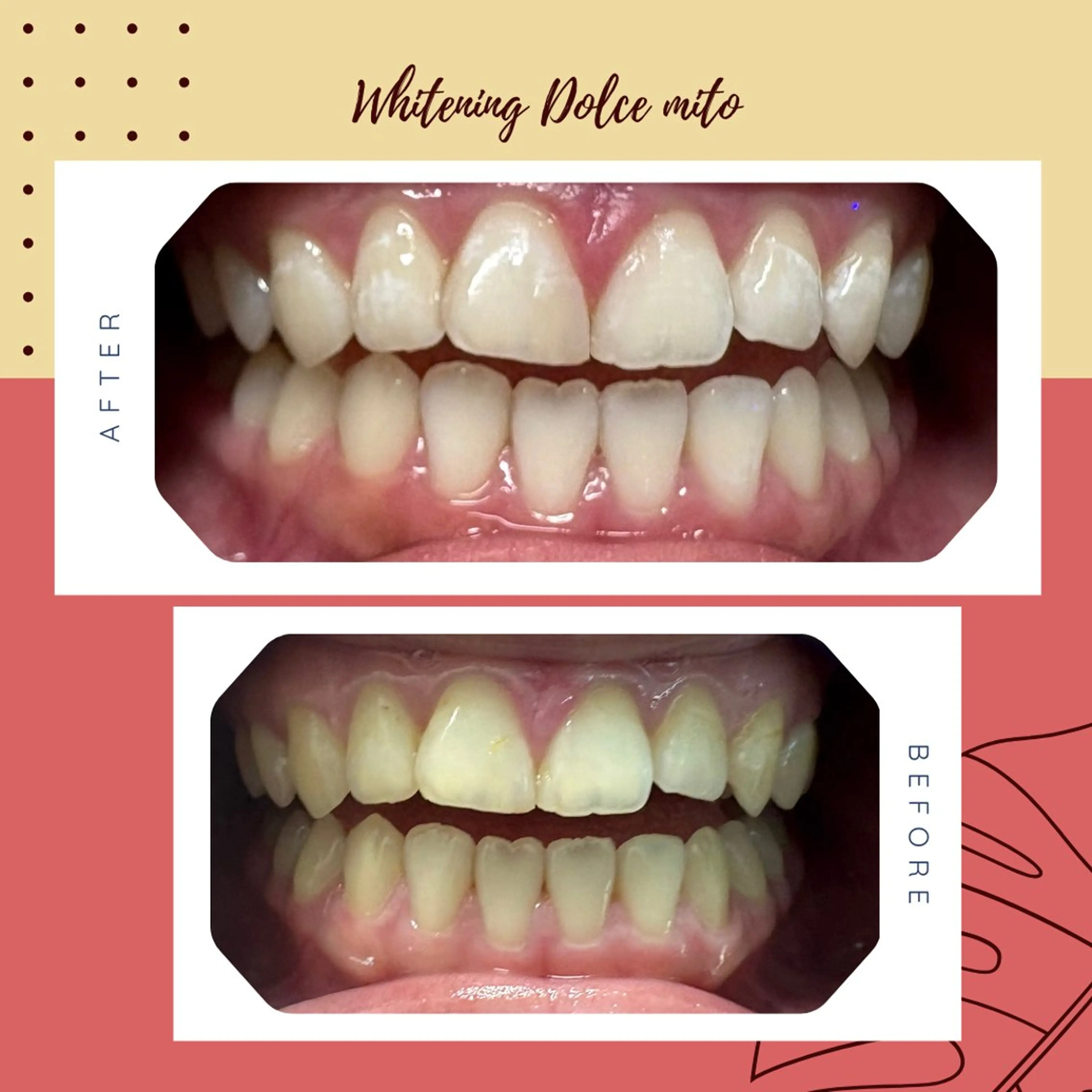 セルフホワイトニング Dolce水戸店のその他イメージ