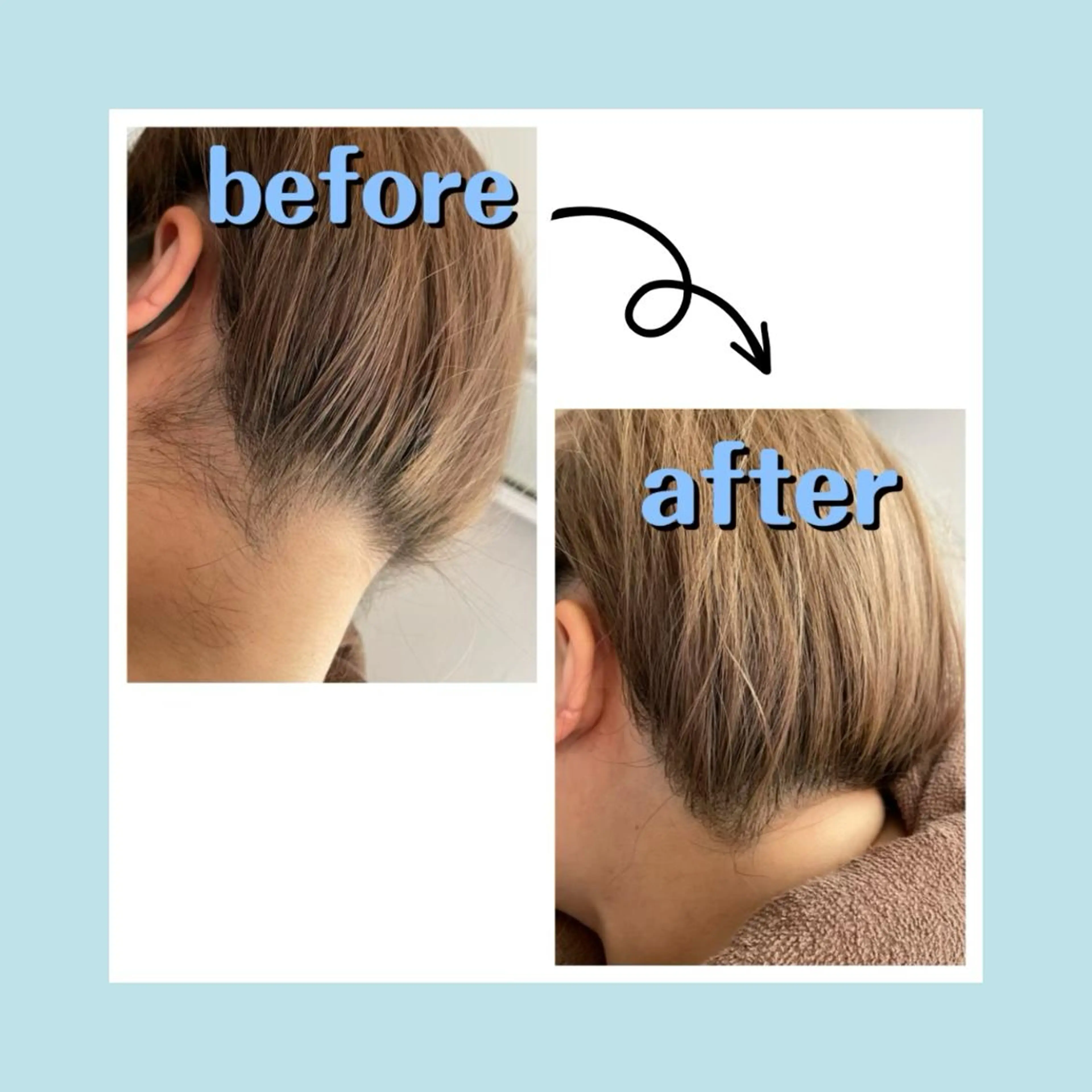 脱毛 salonde ReGodのエステ・リラクイメージ