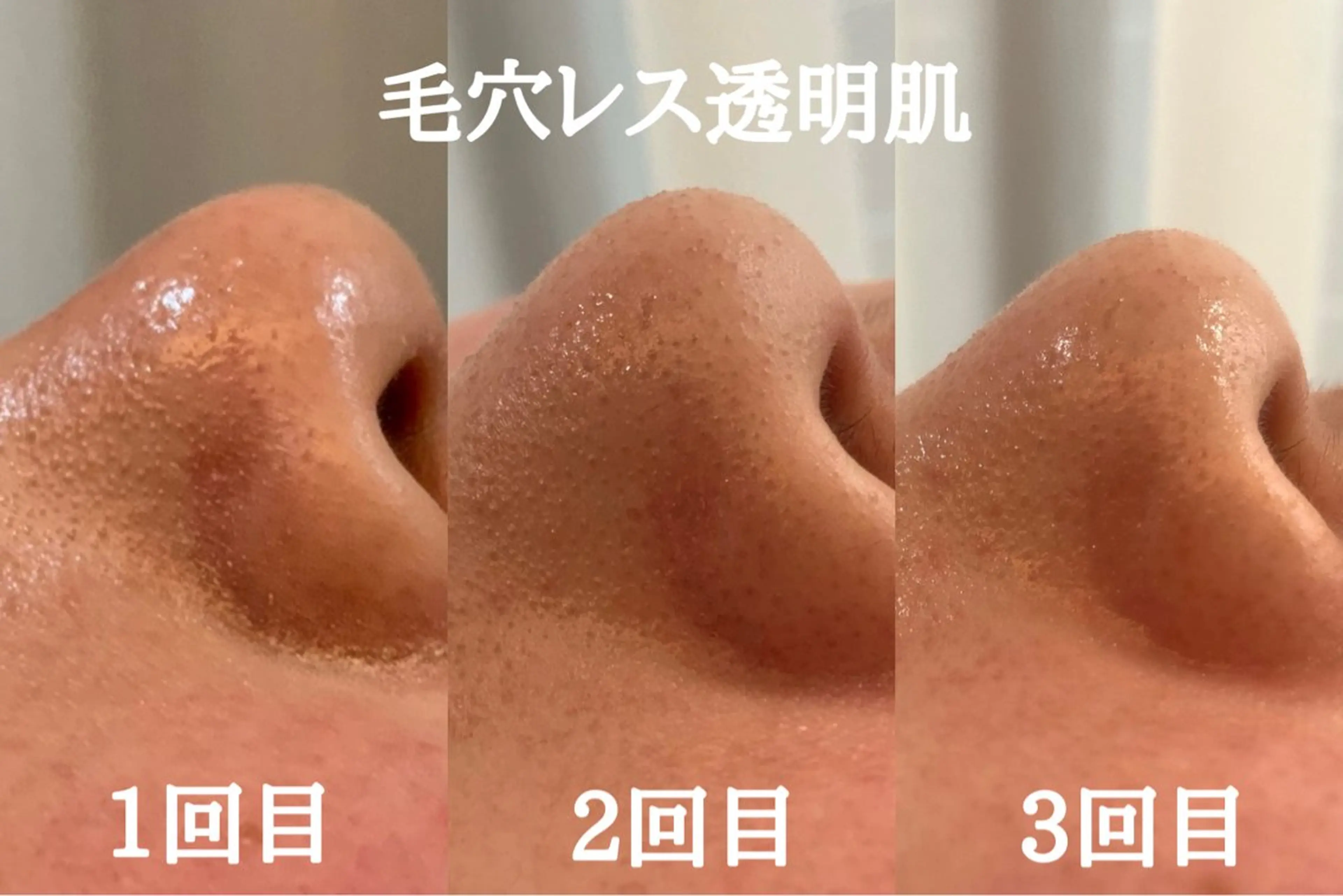 最速小顔・肌質管理 ❣️エスポワールのエステ・リラクイメージ