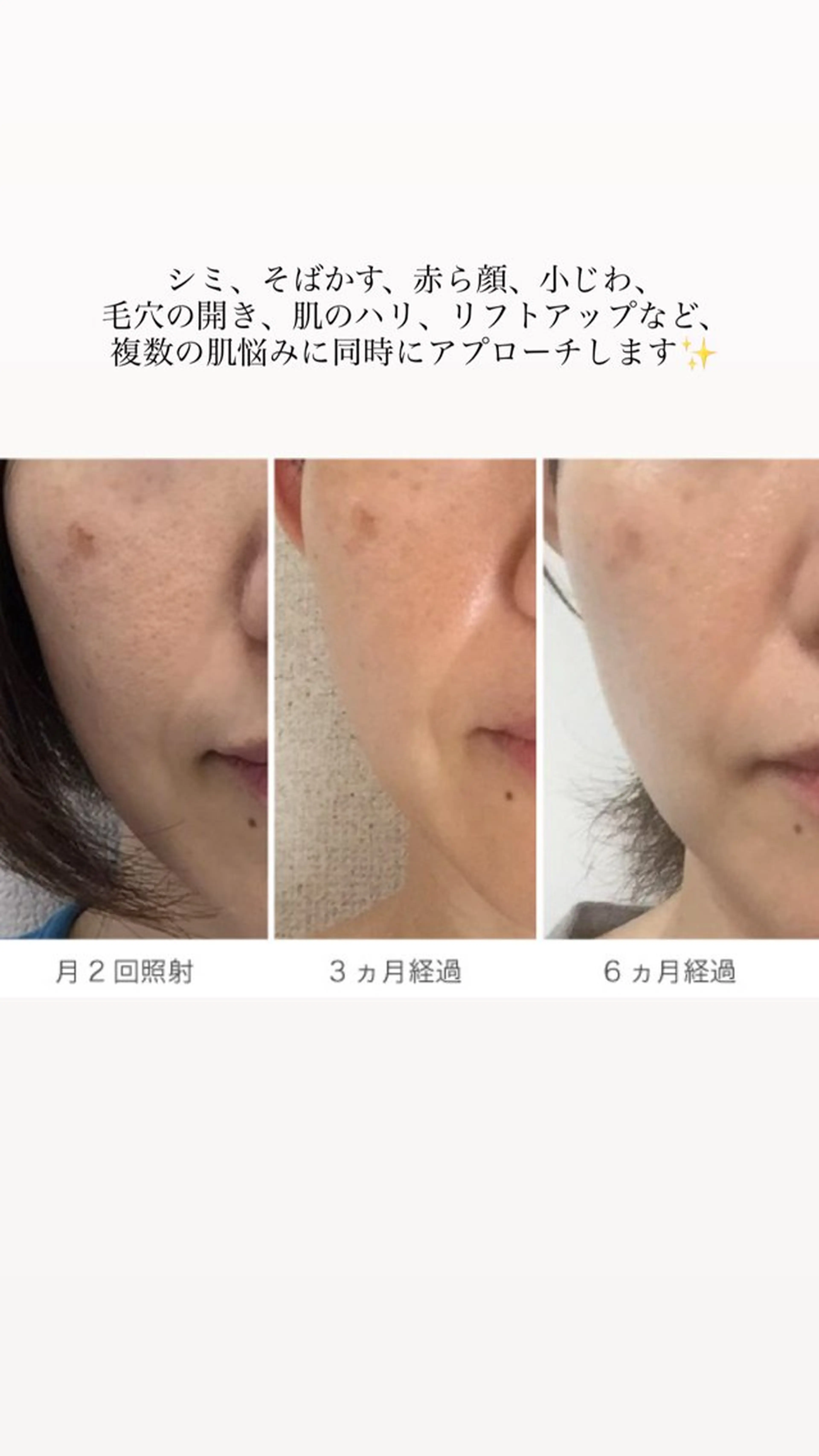エステ Avenir所属・Sakumoto Miuの眉毛・アイブロウイメージ