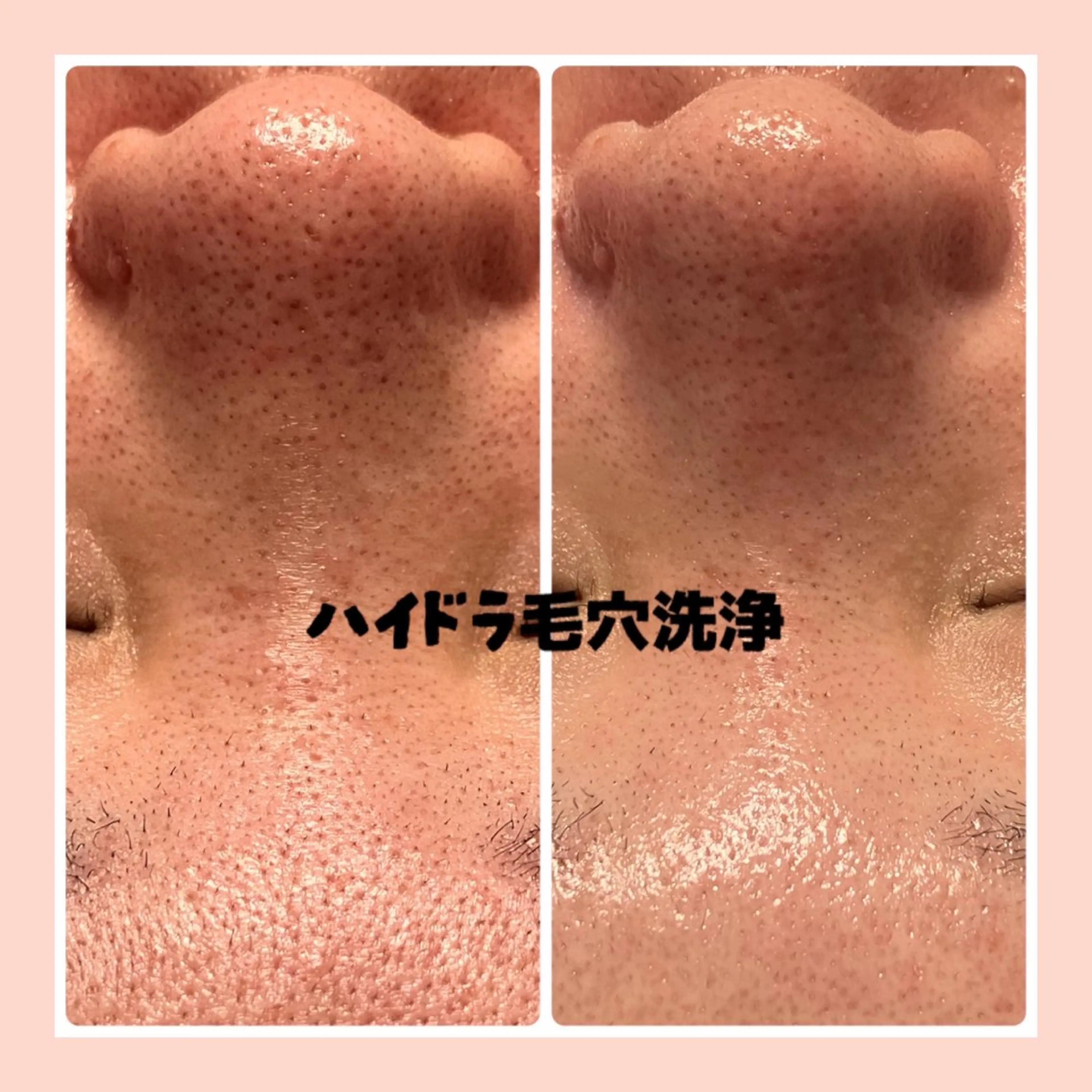 檜山 feliceのエステ・リラクイメージ