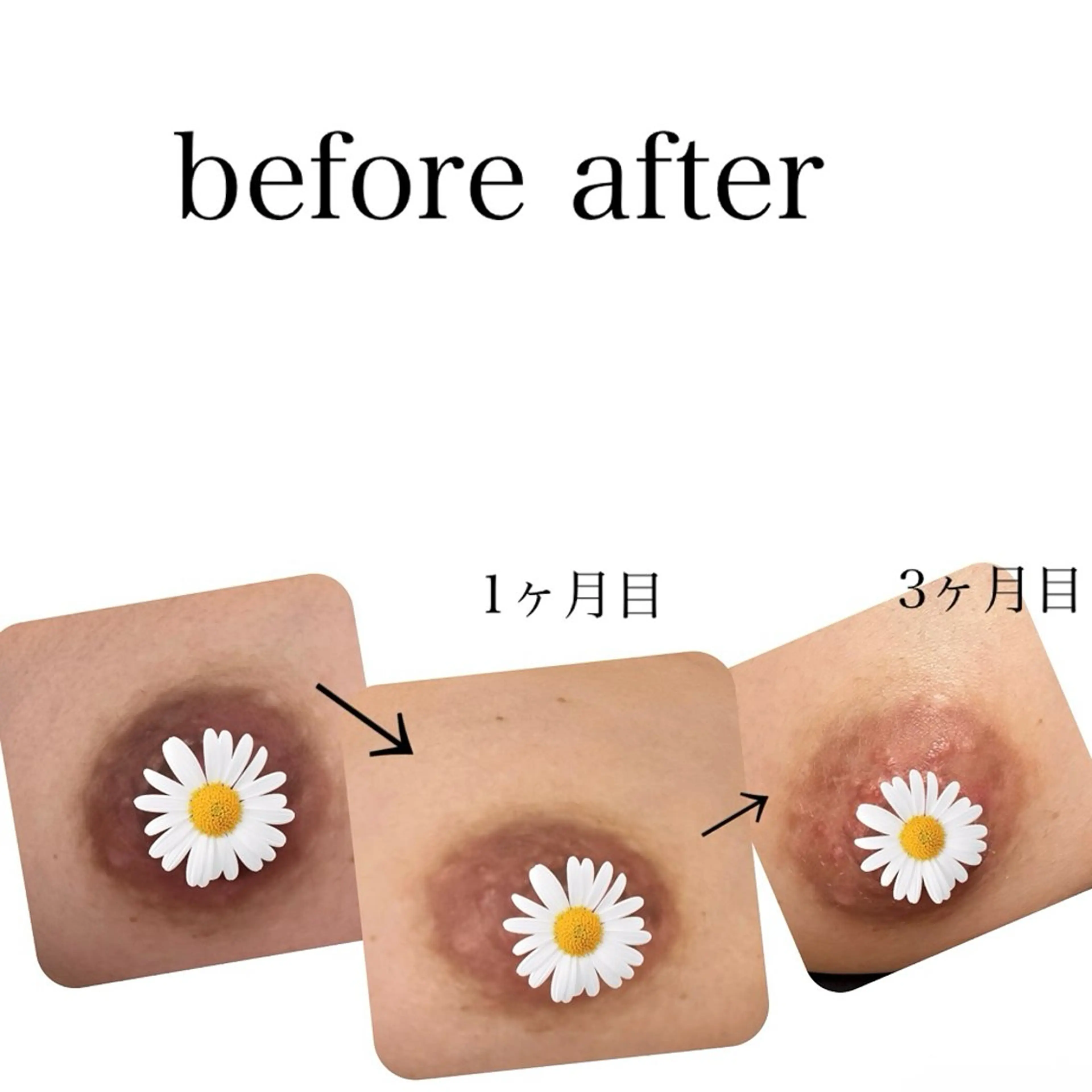 その他 Laetitia所属・美肌✖️ローマピンク レティティア秋葉原店のその他イメージ