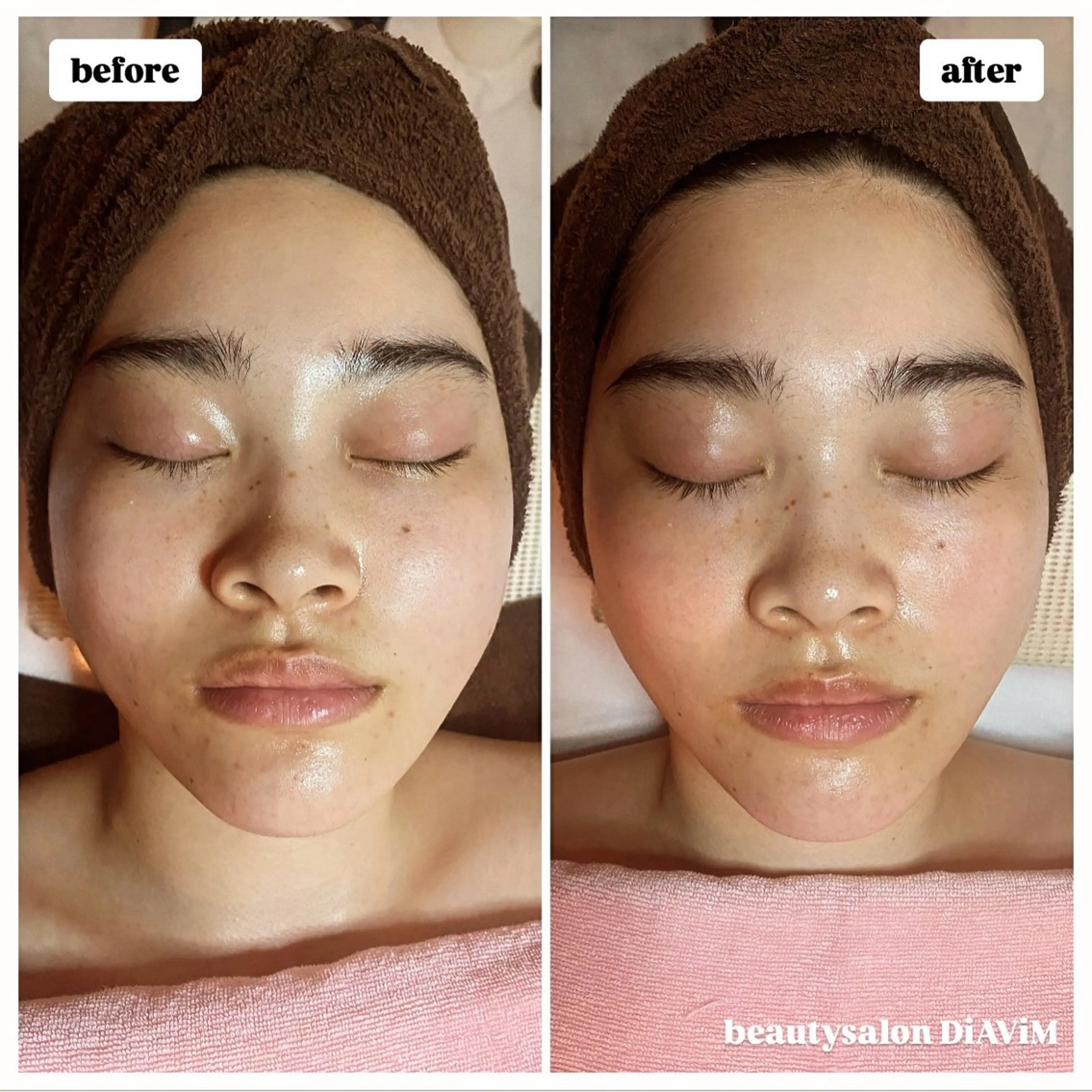 エステ リラク beautysalon  DiAViM所属・本格コルギ美肌美眉 DiAViM 💎のエステ・リラクイメージ