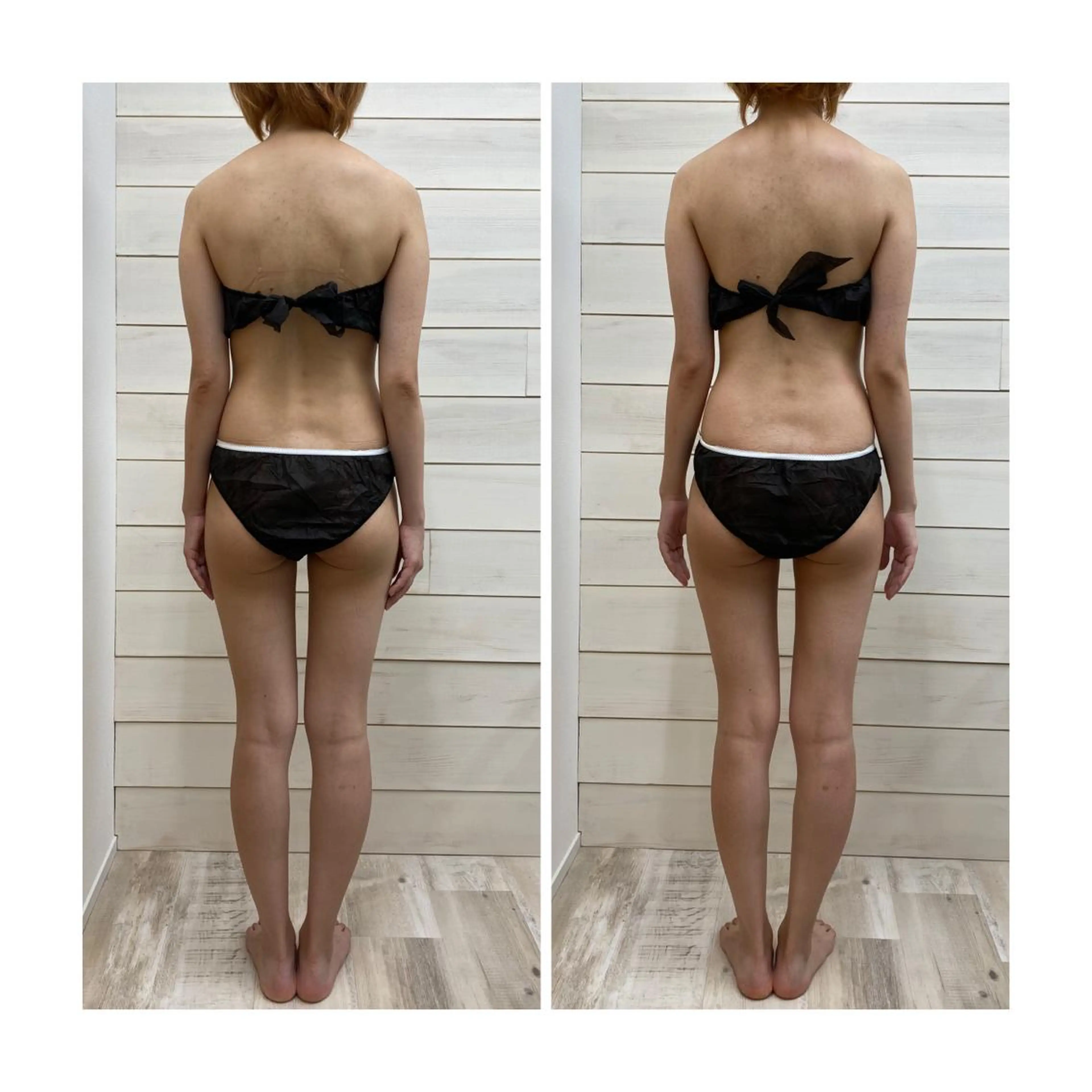 人気No.2 【姿勢改善】全身筋膜リリース✖️美容整体☆ストレッチ込　130分の写真