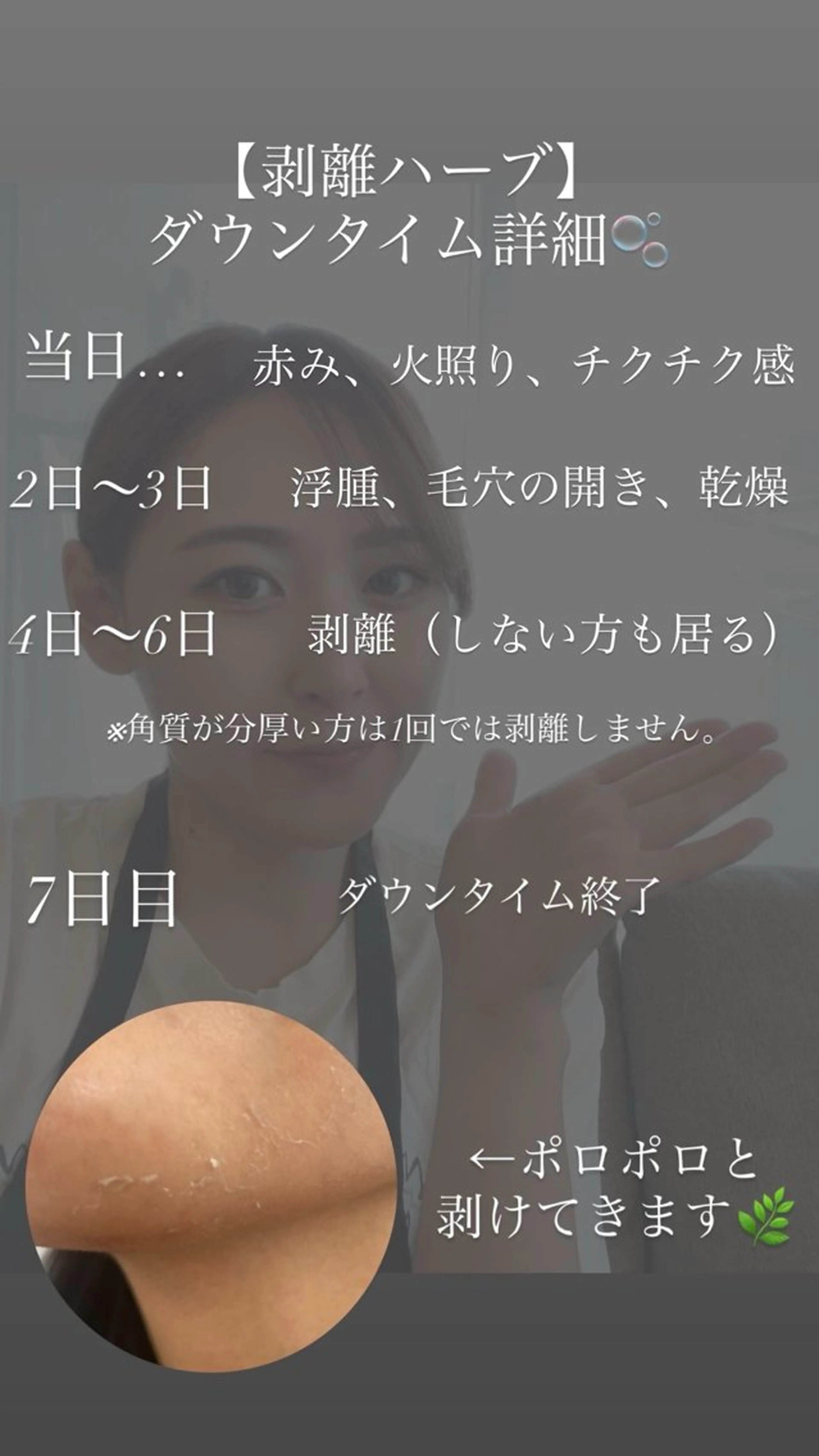 肌質改善ハーブ ピーリングBellaのエステ・リラクイメージ