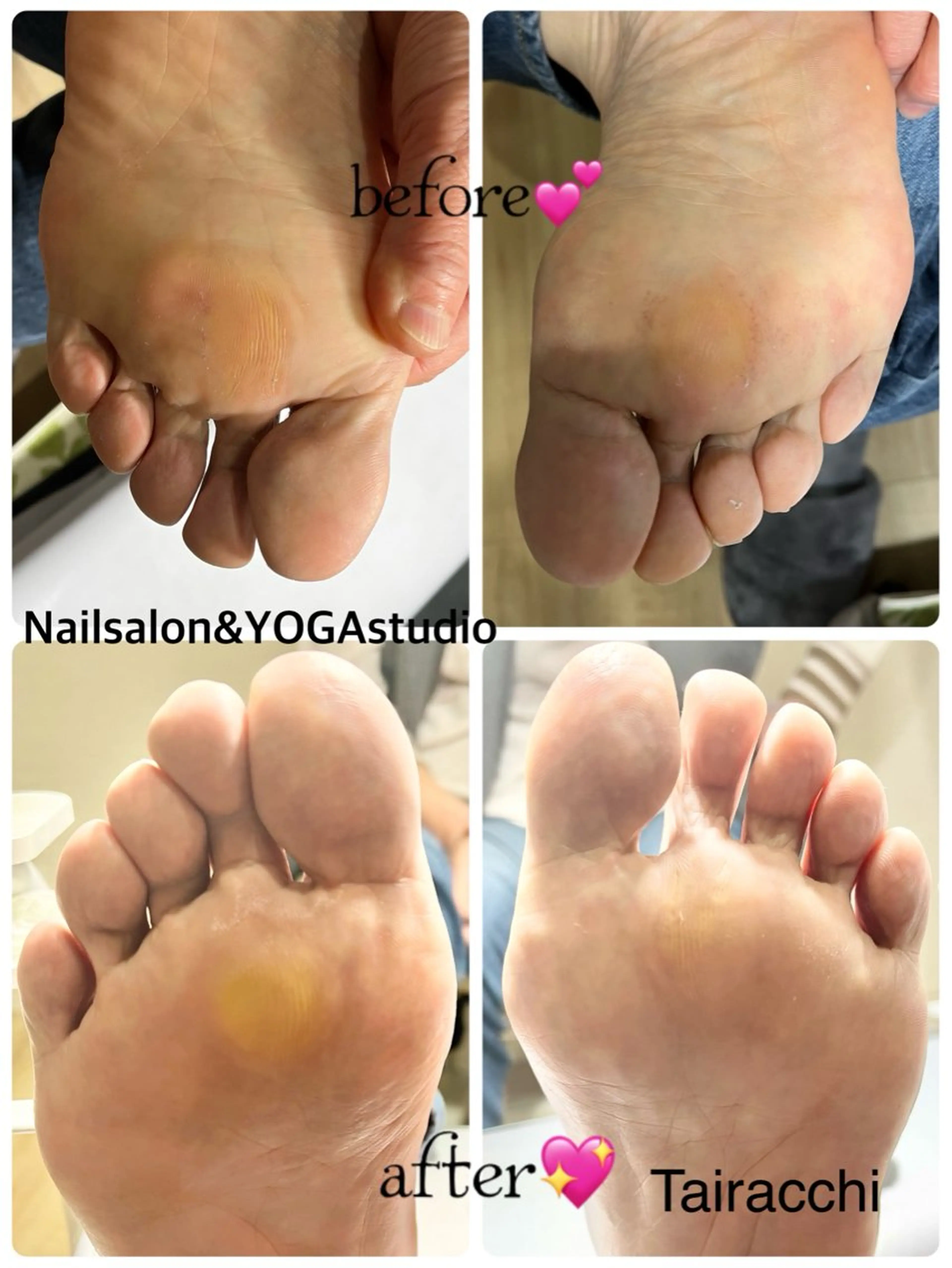 ネイル フットネイル マットネイル フットネイル Tairacchi ﾀｲﾗｯﾁのエステ・リラクイメージ