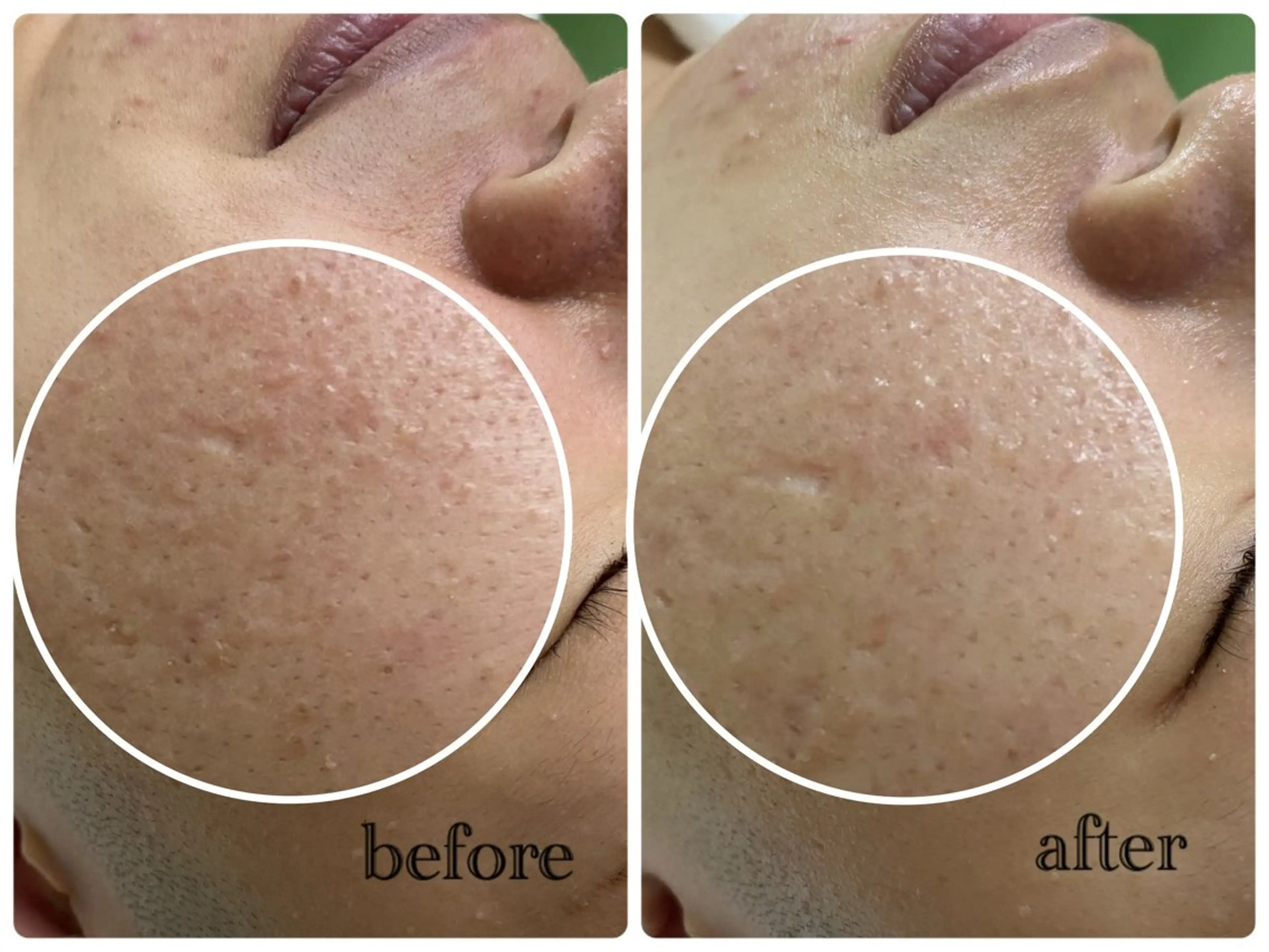 デ・アイム新潟北所属・サイトウ .のエステ・リラクイメージ