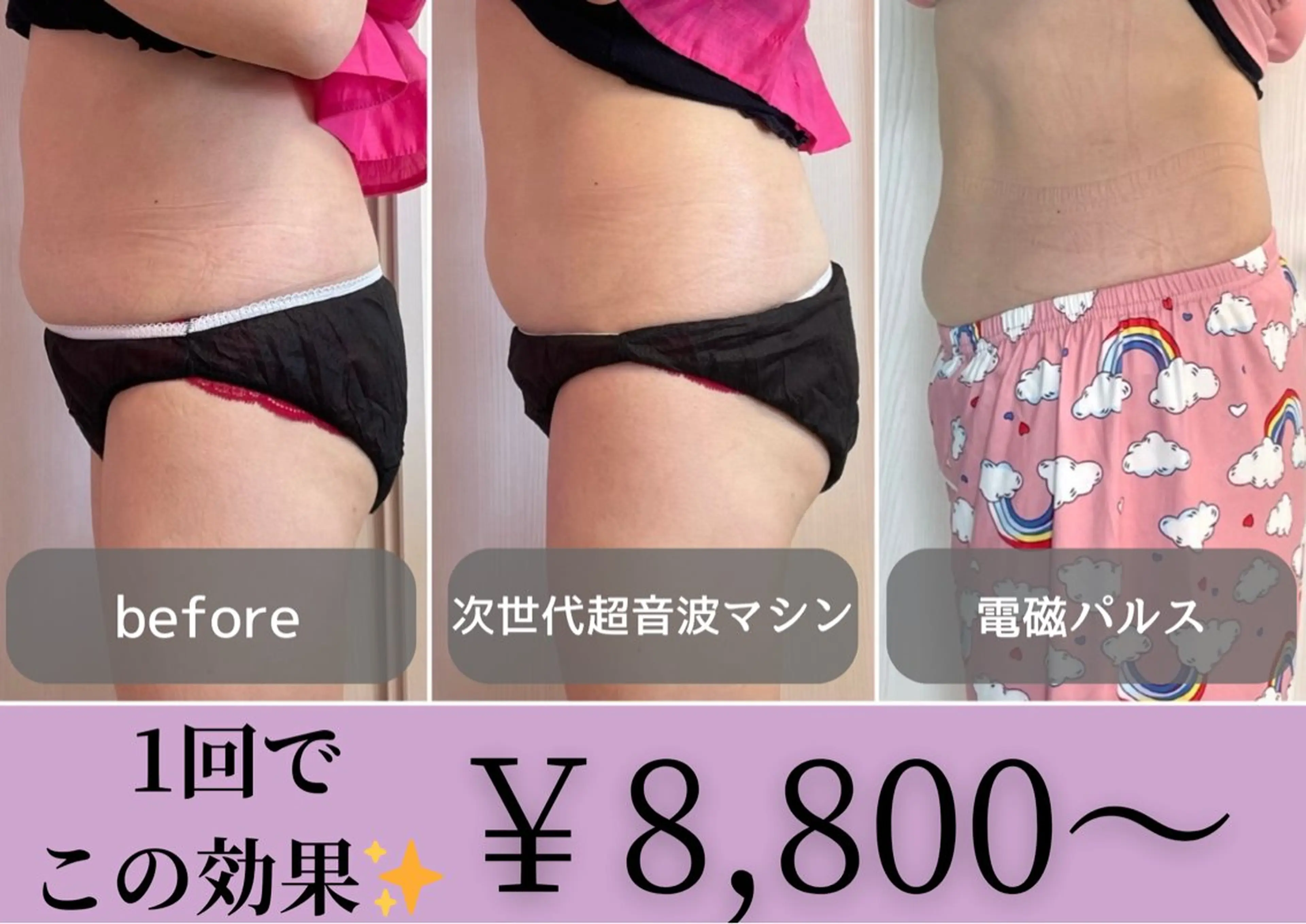 小顔矯正専門店 【RED】池田のエステ・リラクイメージ