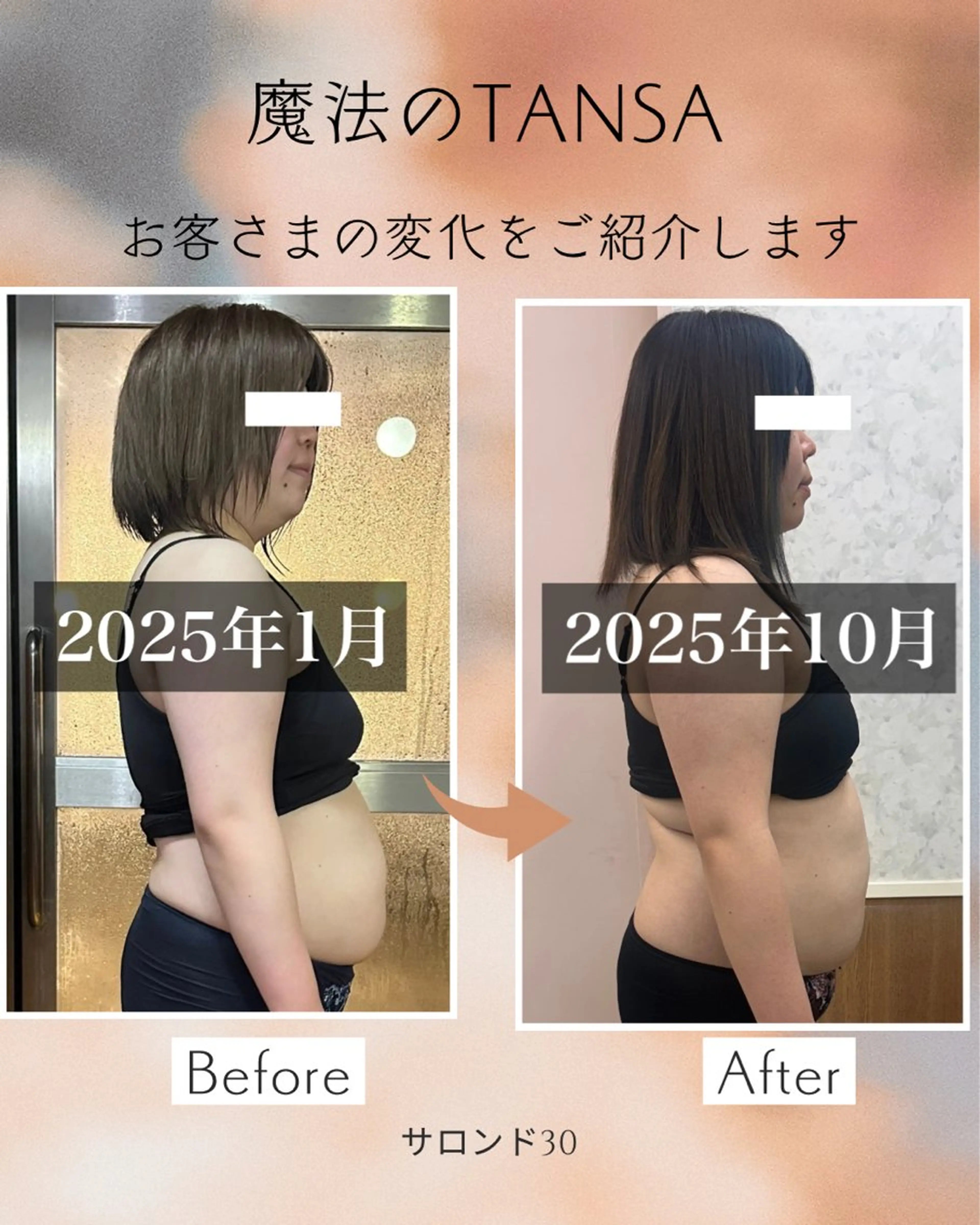 腸活プログラム＋魔法のTANSA約1ヶ月分付き🪄の写真