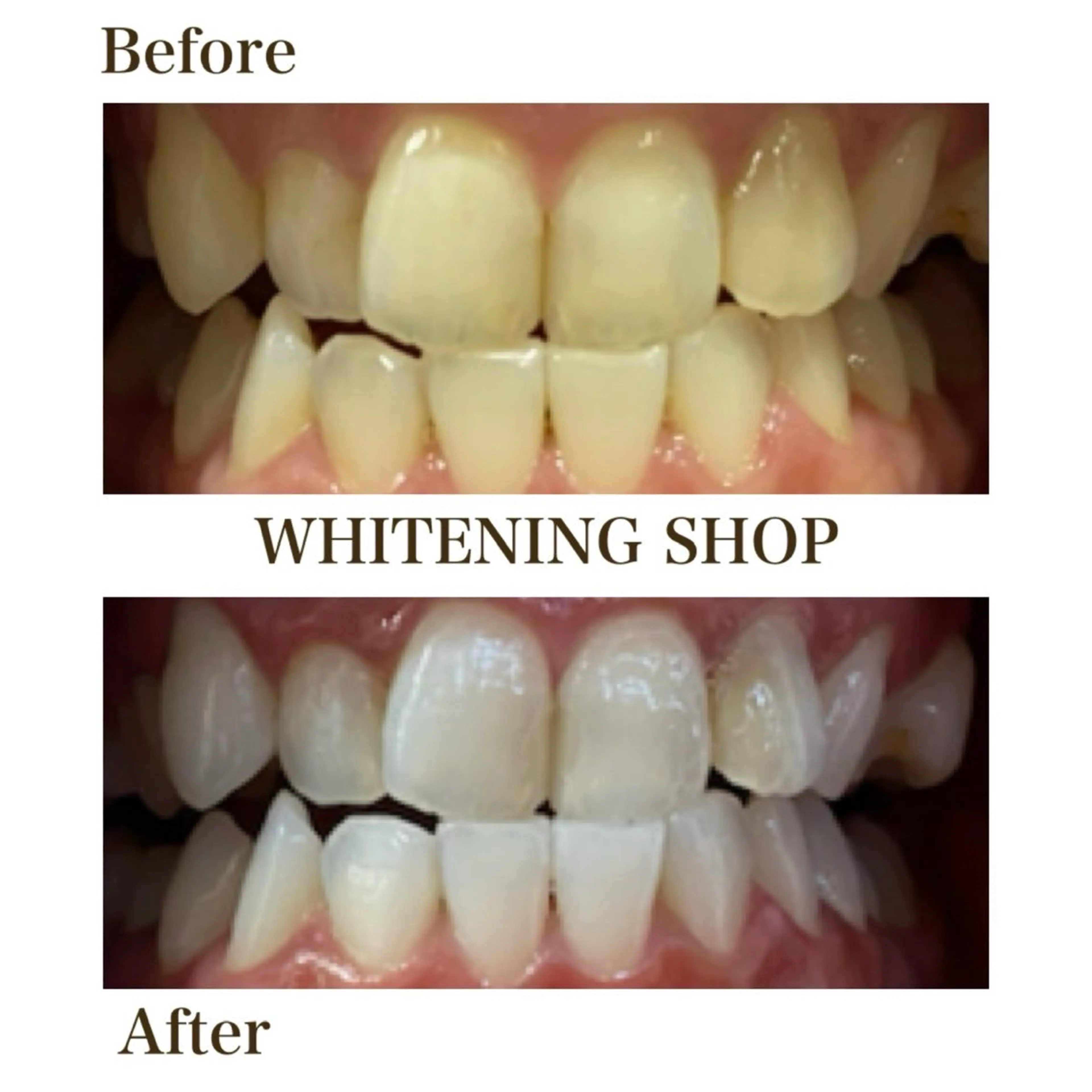 その他 ホワイトニングショップ静岡葵区店所属・ホワイトニング ショップ静岡葵区店のその他イメージ