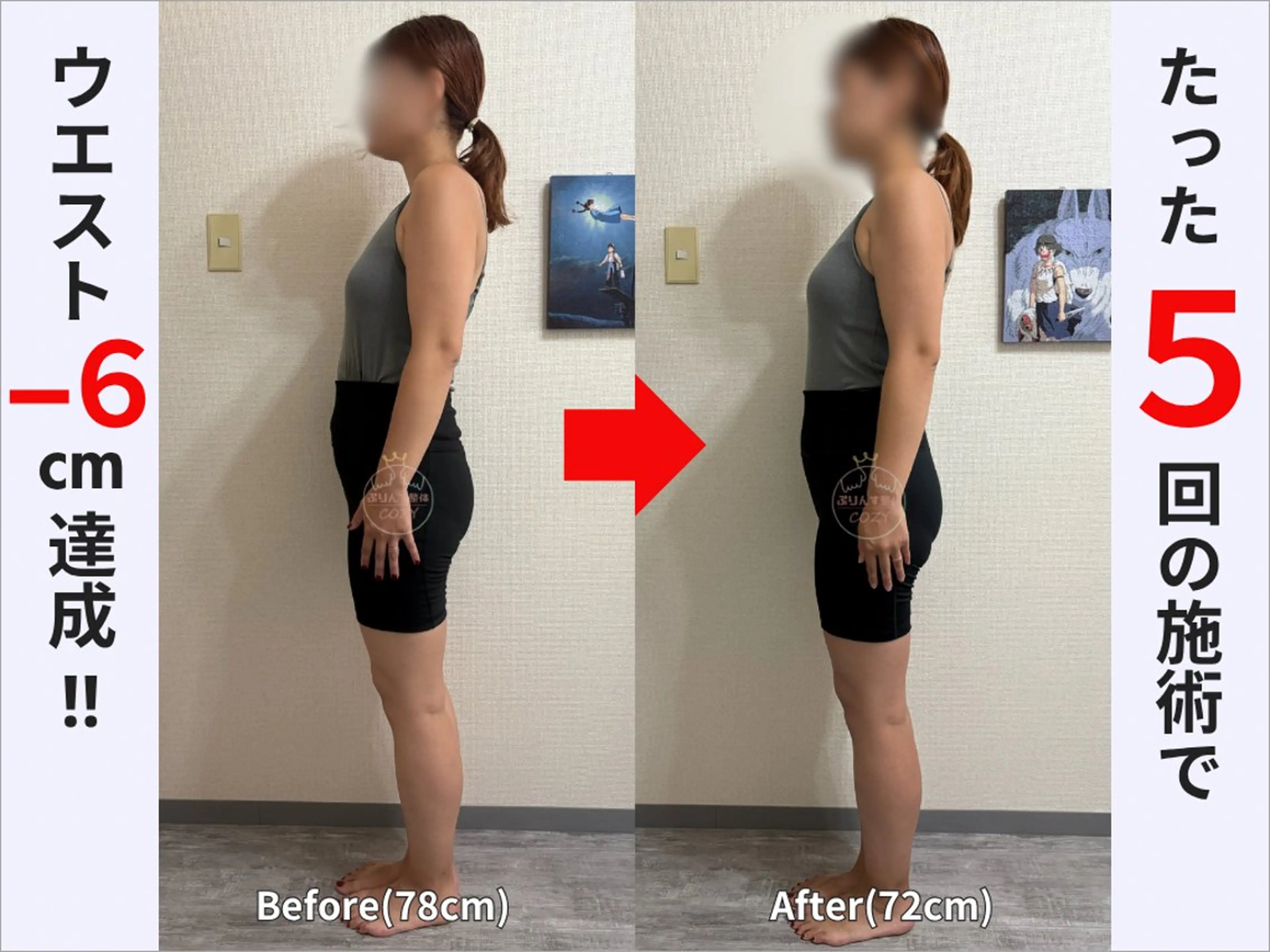 エステ リラク 骨盤矯正ダイエット ぷりんす整体COZYのエステ・リラクイメージ