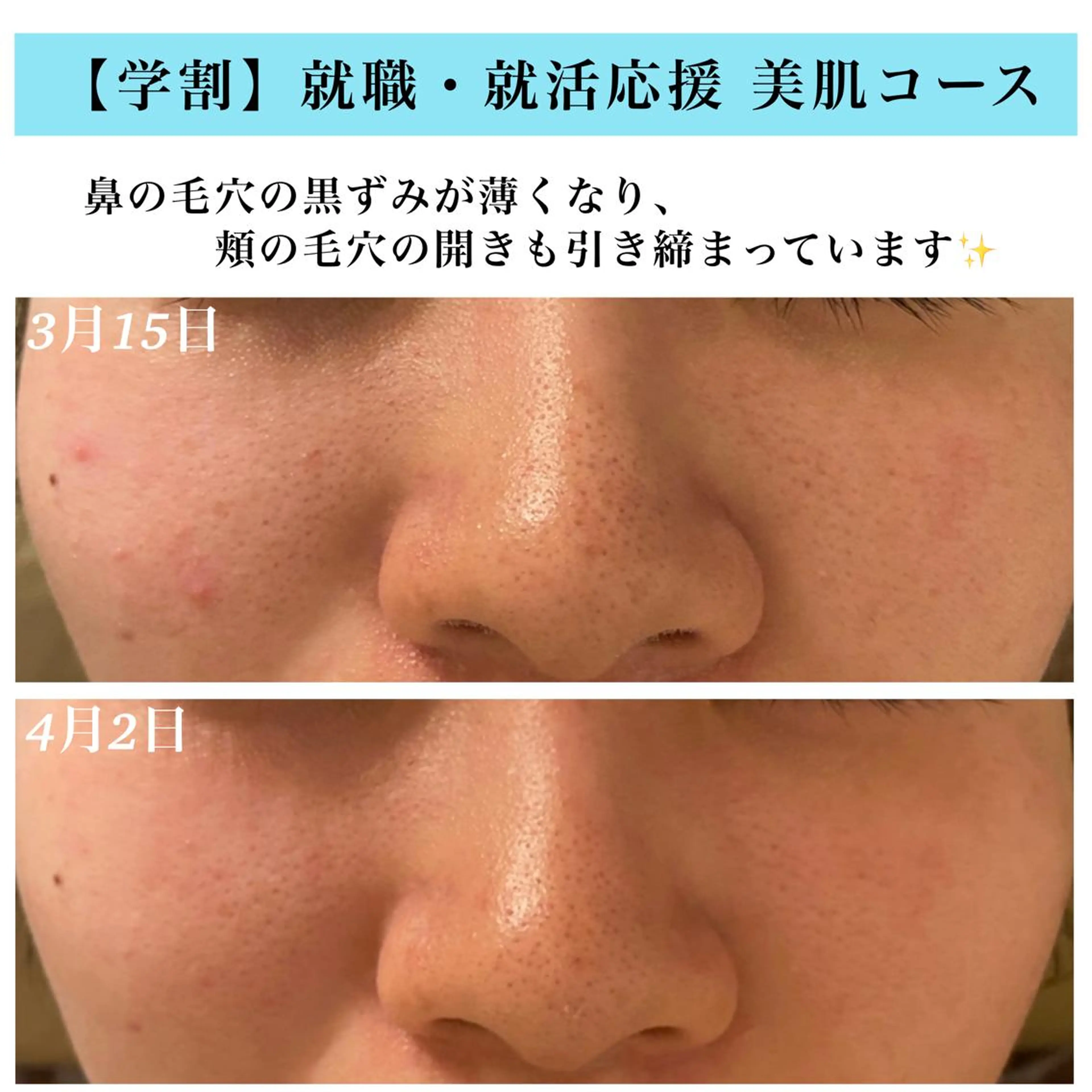 エステ Bellesthe （ベルエステ）のエステ・リラクイメージ