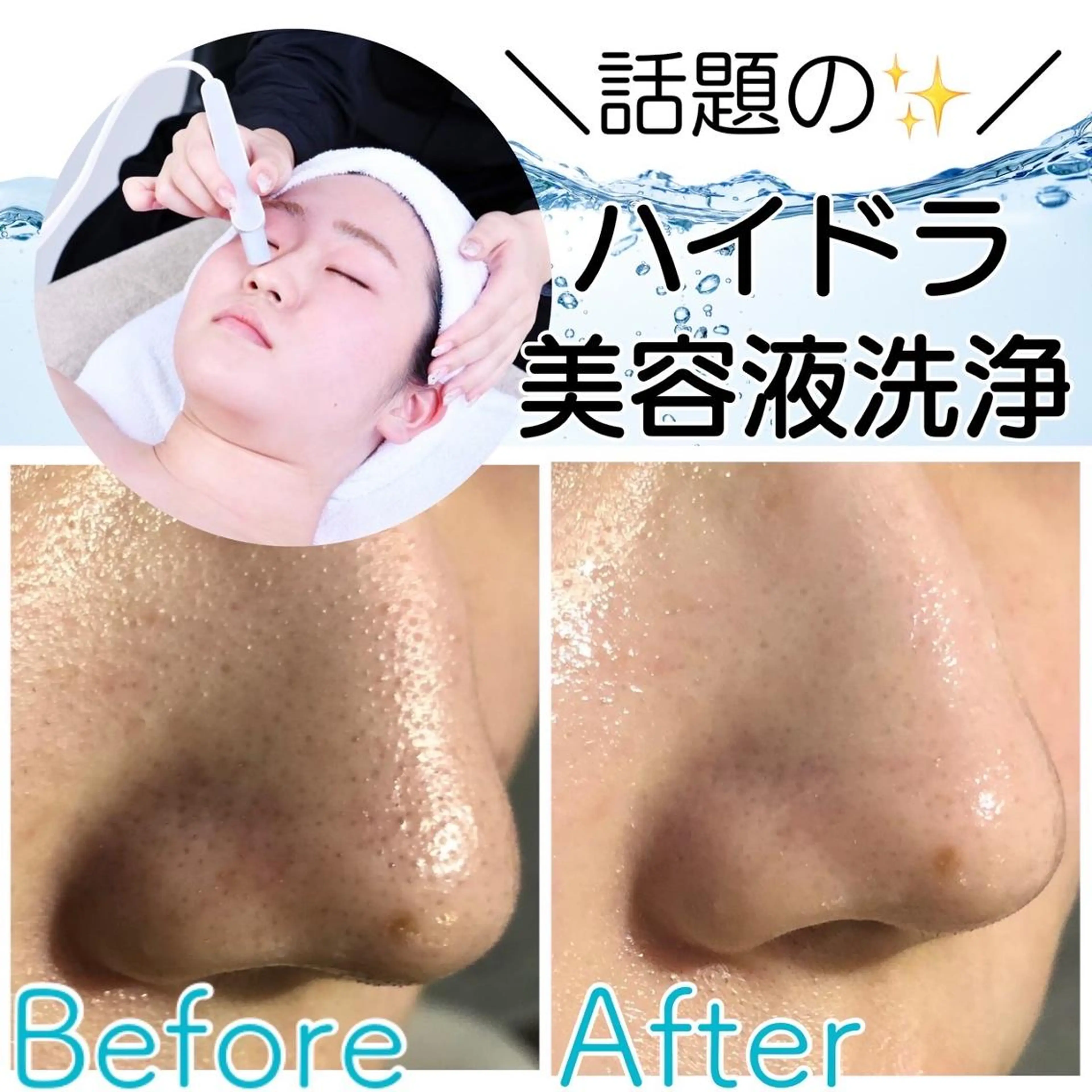 【モニター専用】 肌質改善サロンのエステ・リラクイメージ