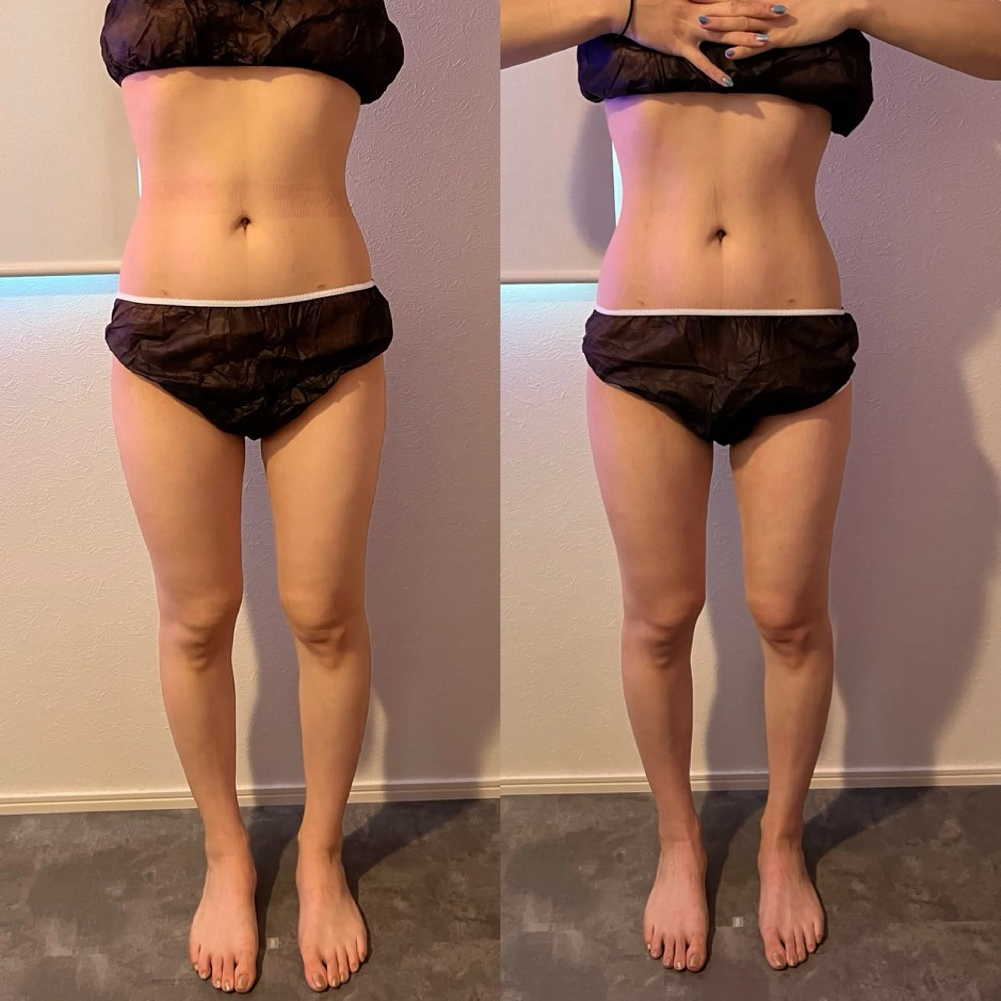 本気で痩せたい方へ 痩身専門サロンのその他イメージ