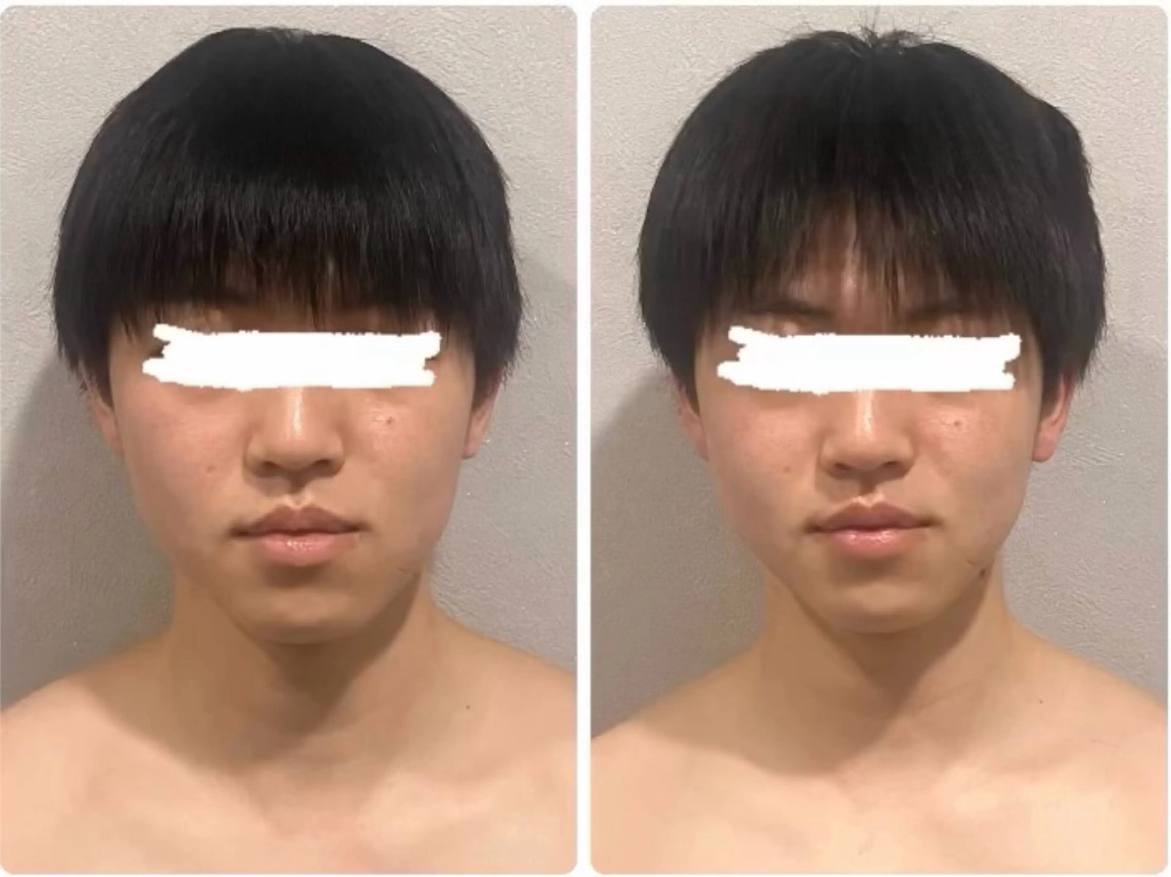 メンズ エステ mi yuのエステ・リラクイメージ