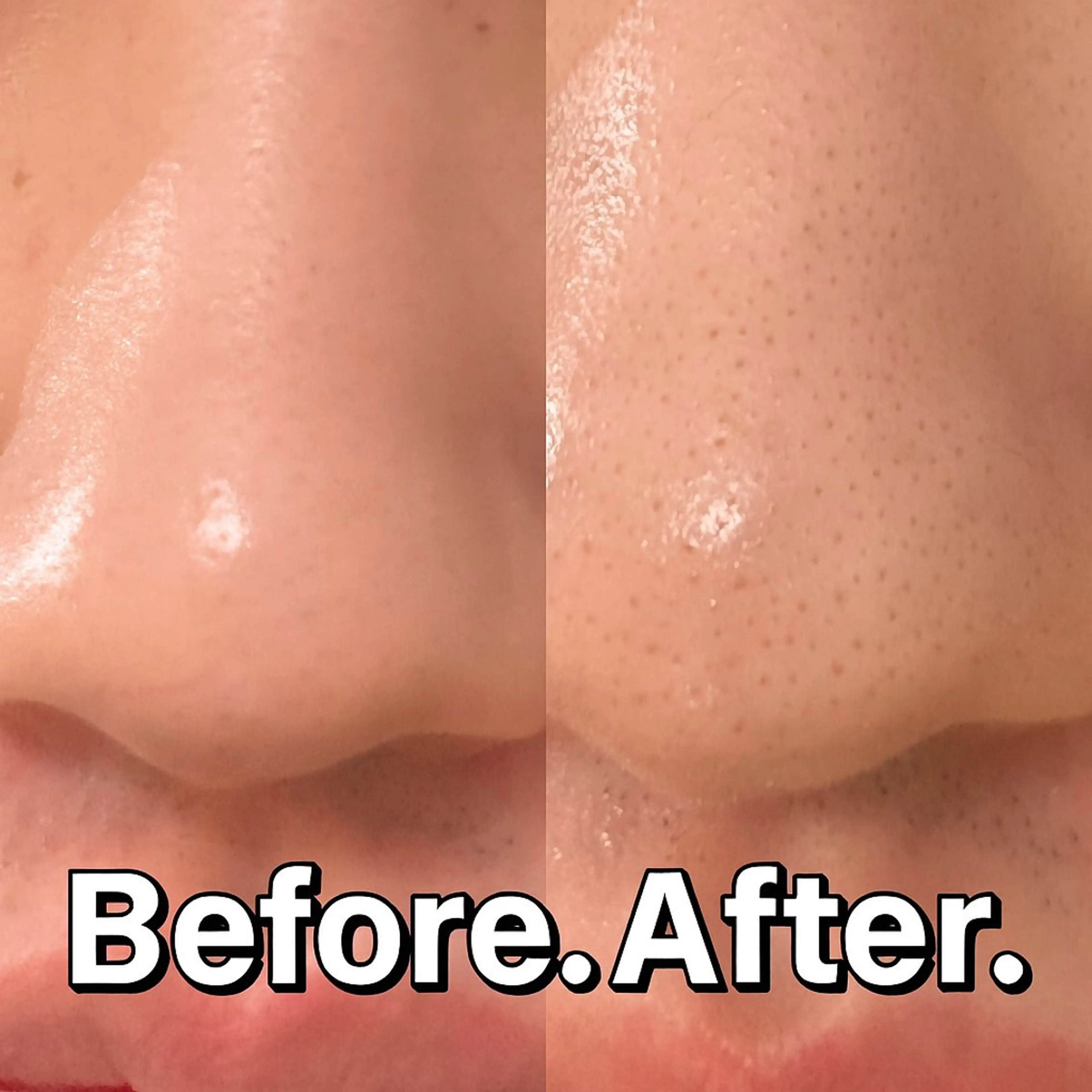 エステ リラク 【ハイパーナイフ痩身&小顔コルギ&ハーブピーリング】K-Beauty　東新宿所属・kーbeauty痩身 フェイシャルのエステ・リラクイメージ