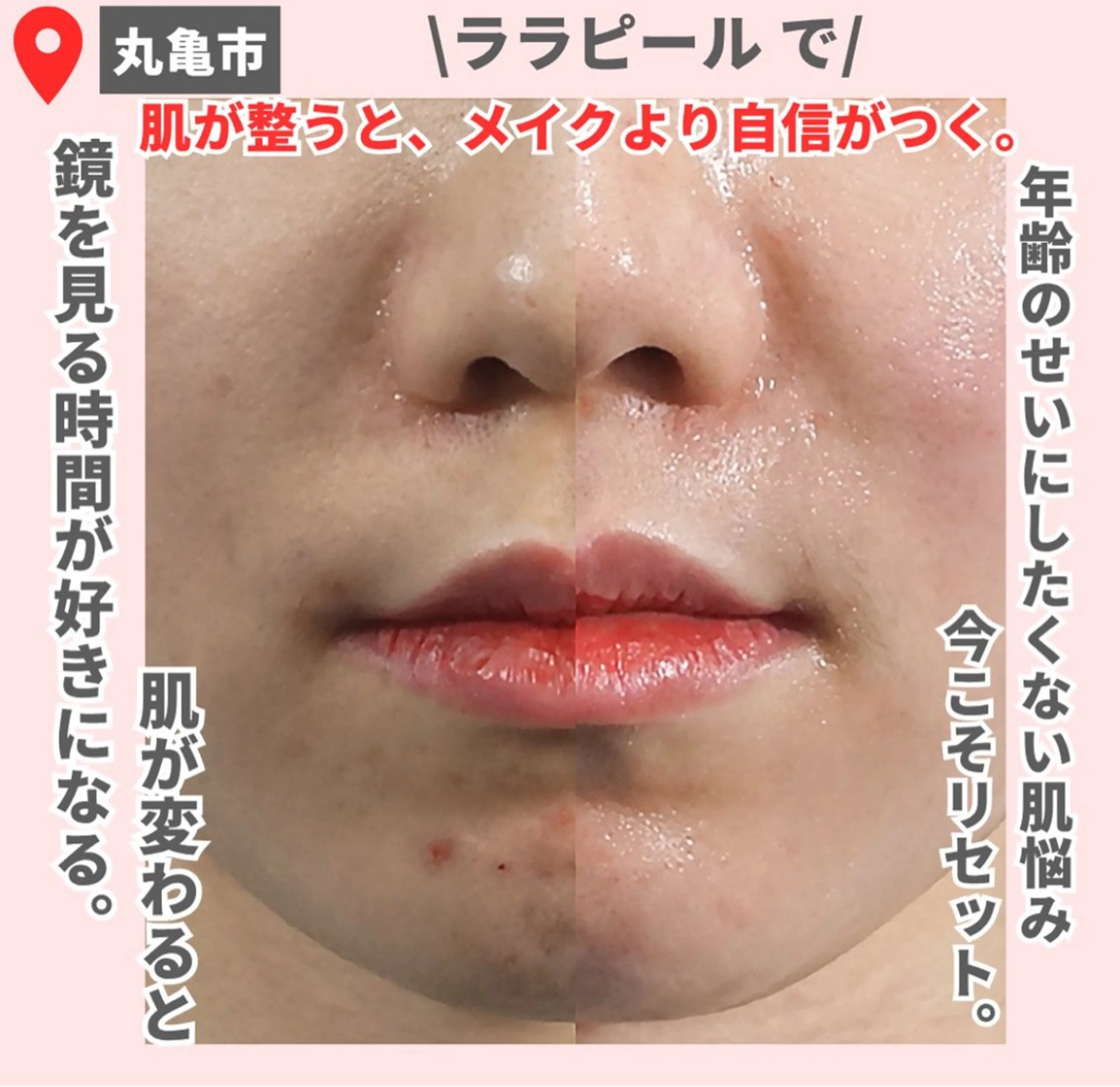 【LEPUS】 sekiのエステ・リラクイメージ