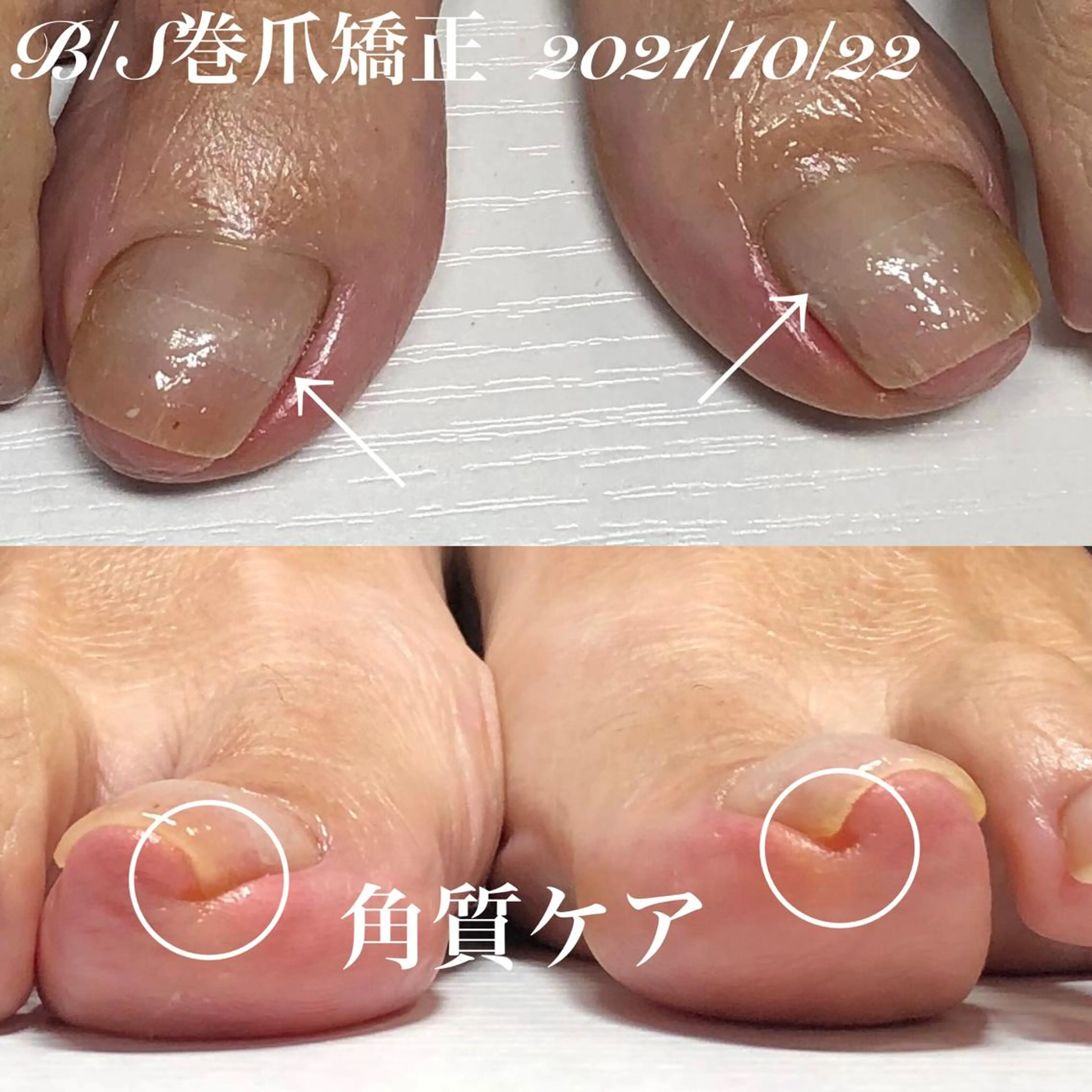 ネイル フットネイル .Nails Mio 赤羽西ネイルサロンのネイルデザイン