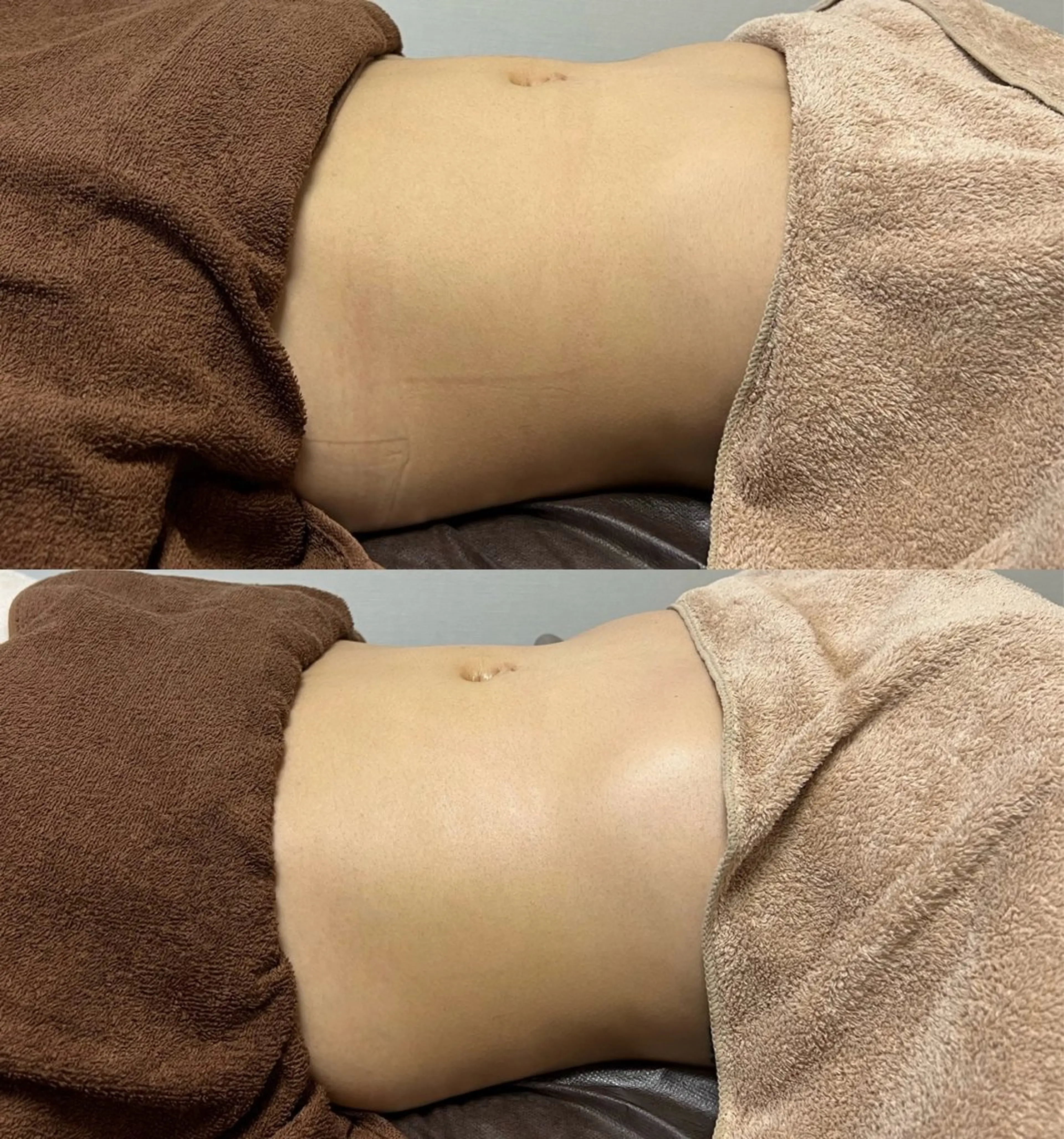 Beauty   Salon  Adiy所属・Adiy ikumiのエステ・リラクイメージ