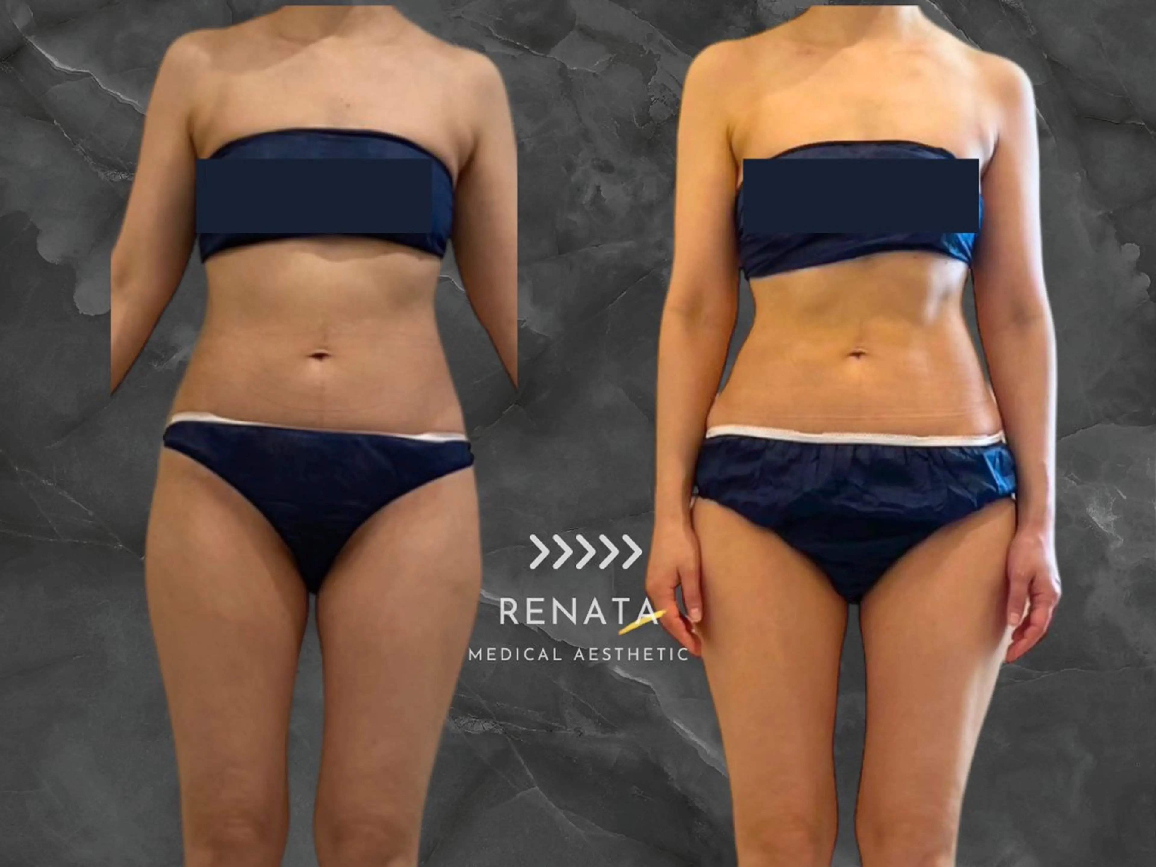 RENATA🕊 脂肪冷却専門店六本木のエステ・リラクイメージ