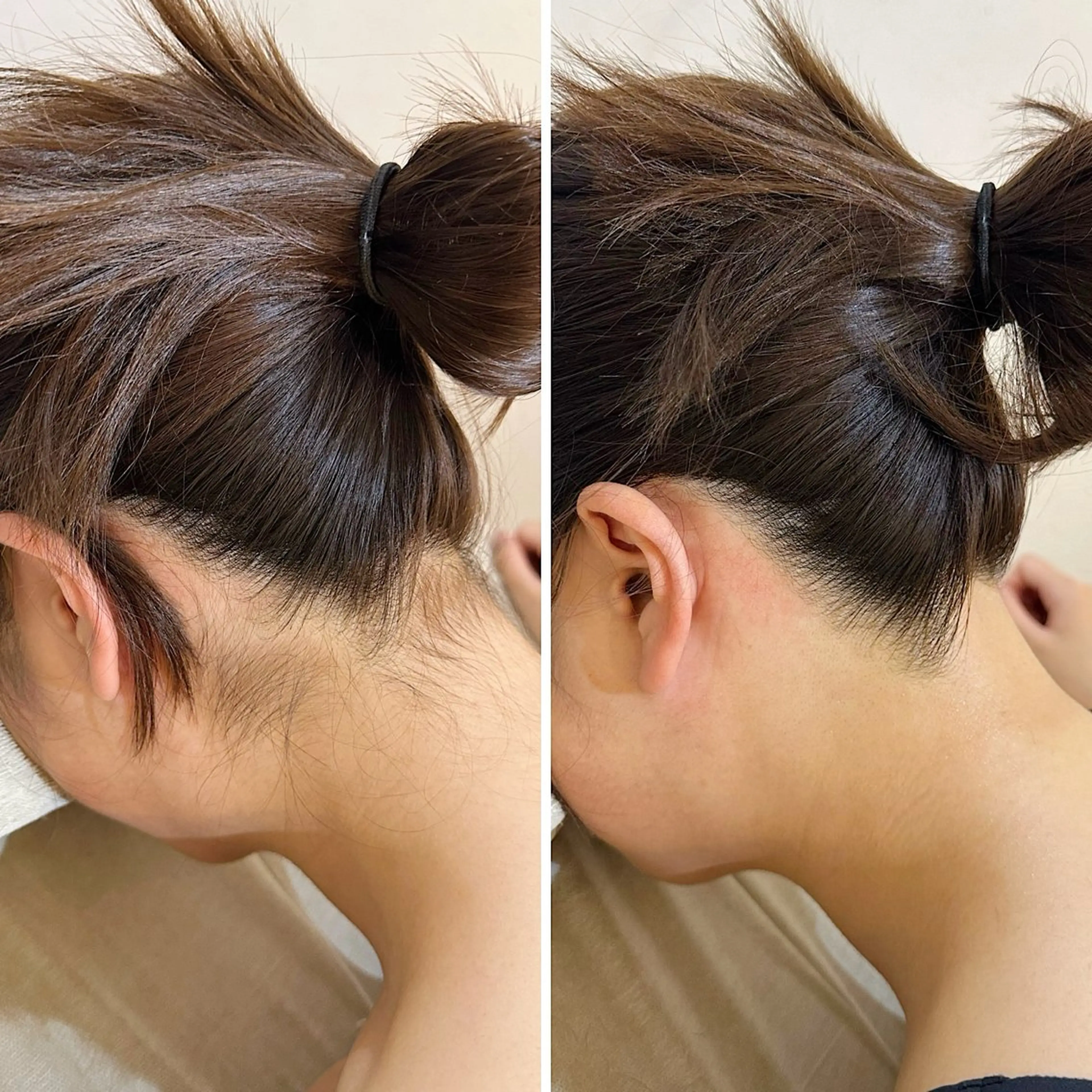 脱毛 うなじ脱毛/美肌脱毛 LABELのエステ・リラクイメージ