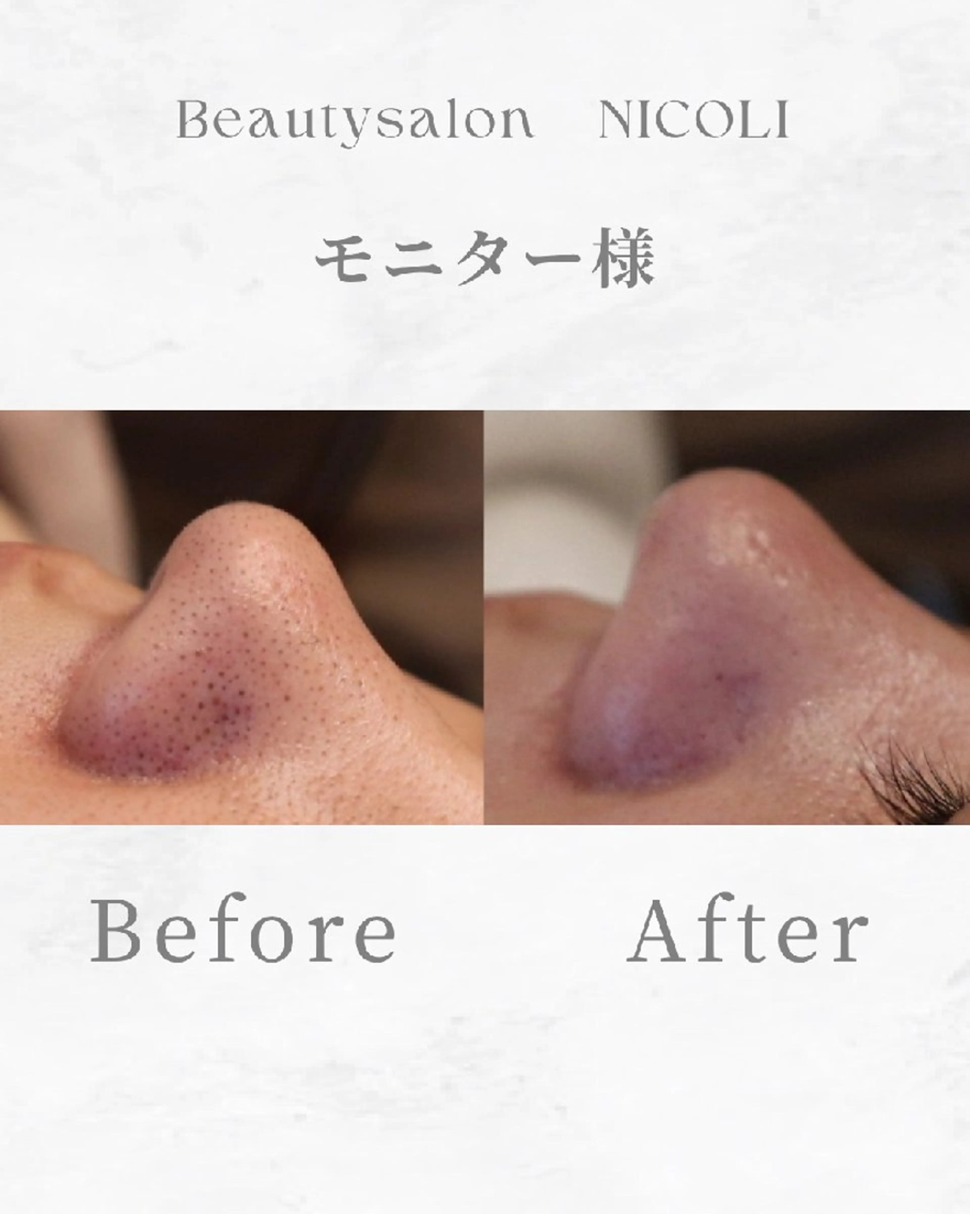 エステ エステサロン NICOLIのエステ・リラクイメージ