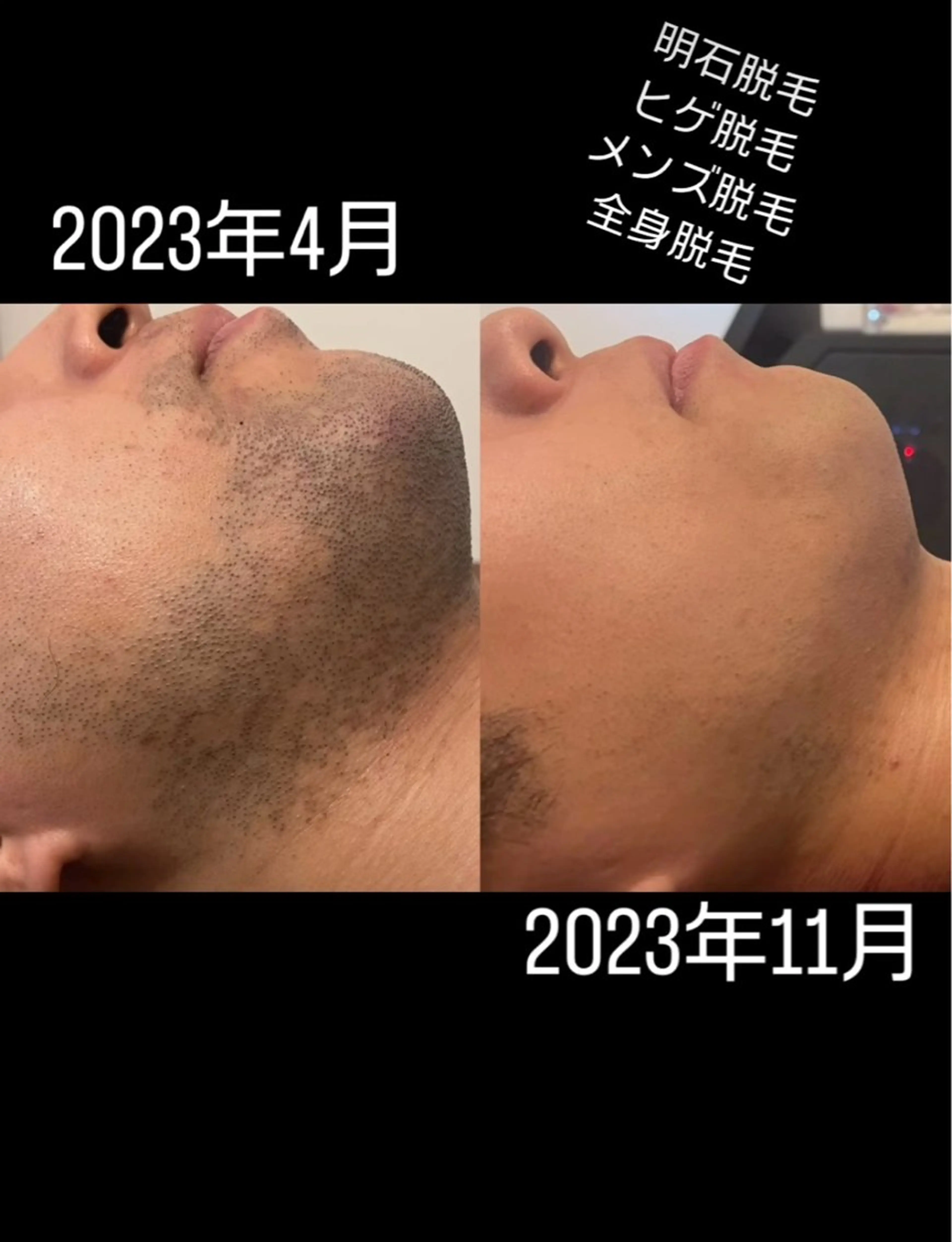 セルフエステエンリケ明石大久保店所属・YUUKI リンパ＆脱毛&毛穴のエステ・リラクイメージ