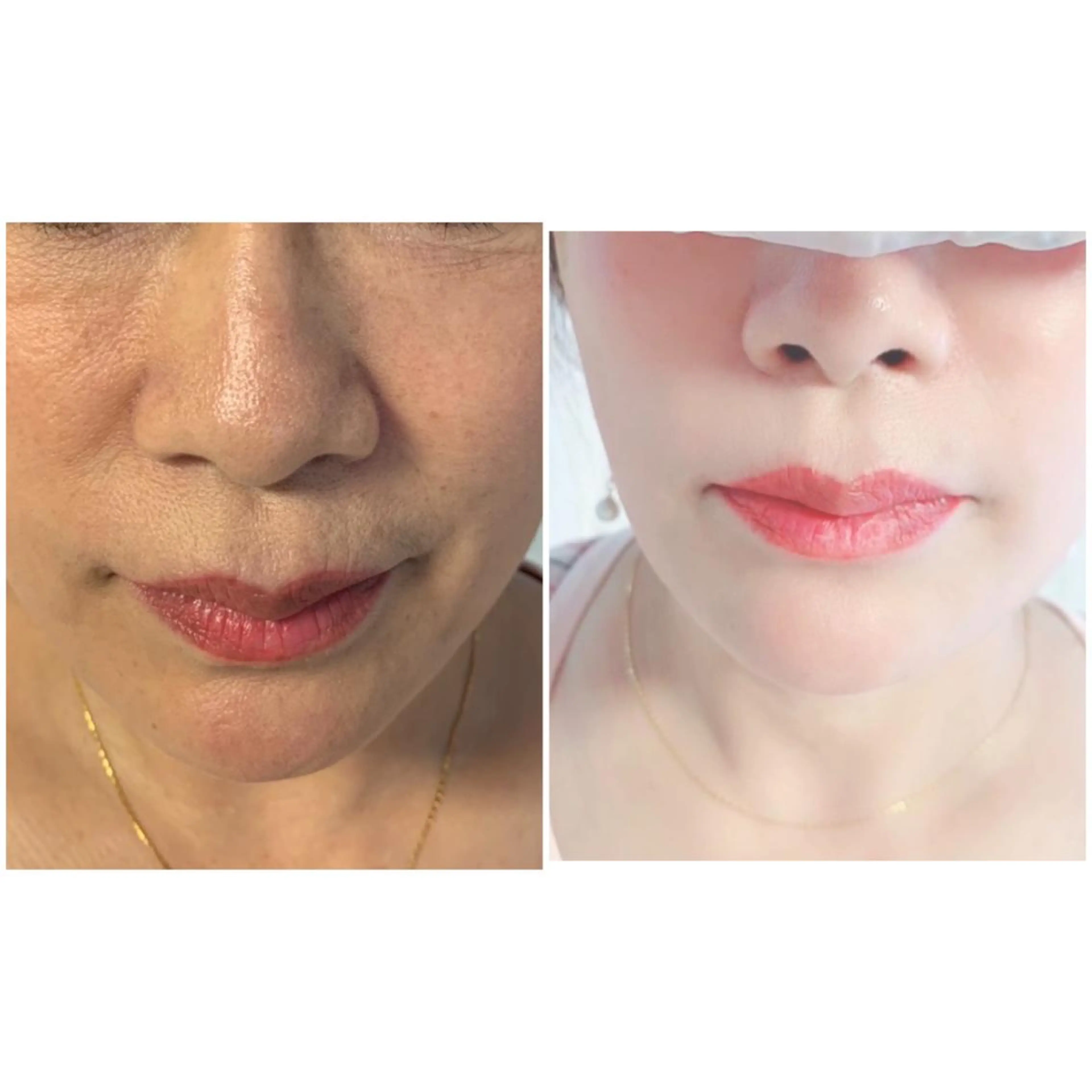 aliaハイフ&水光ジェットサロン所属・aliaハーブ水光店 エステティシャン募集のエステ・リラクイメージ