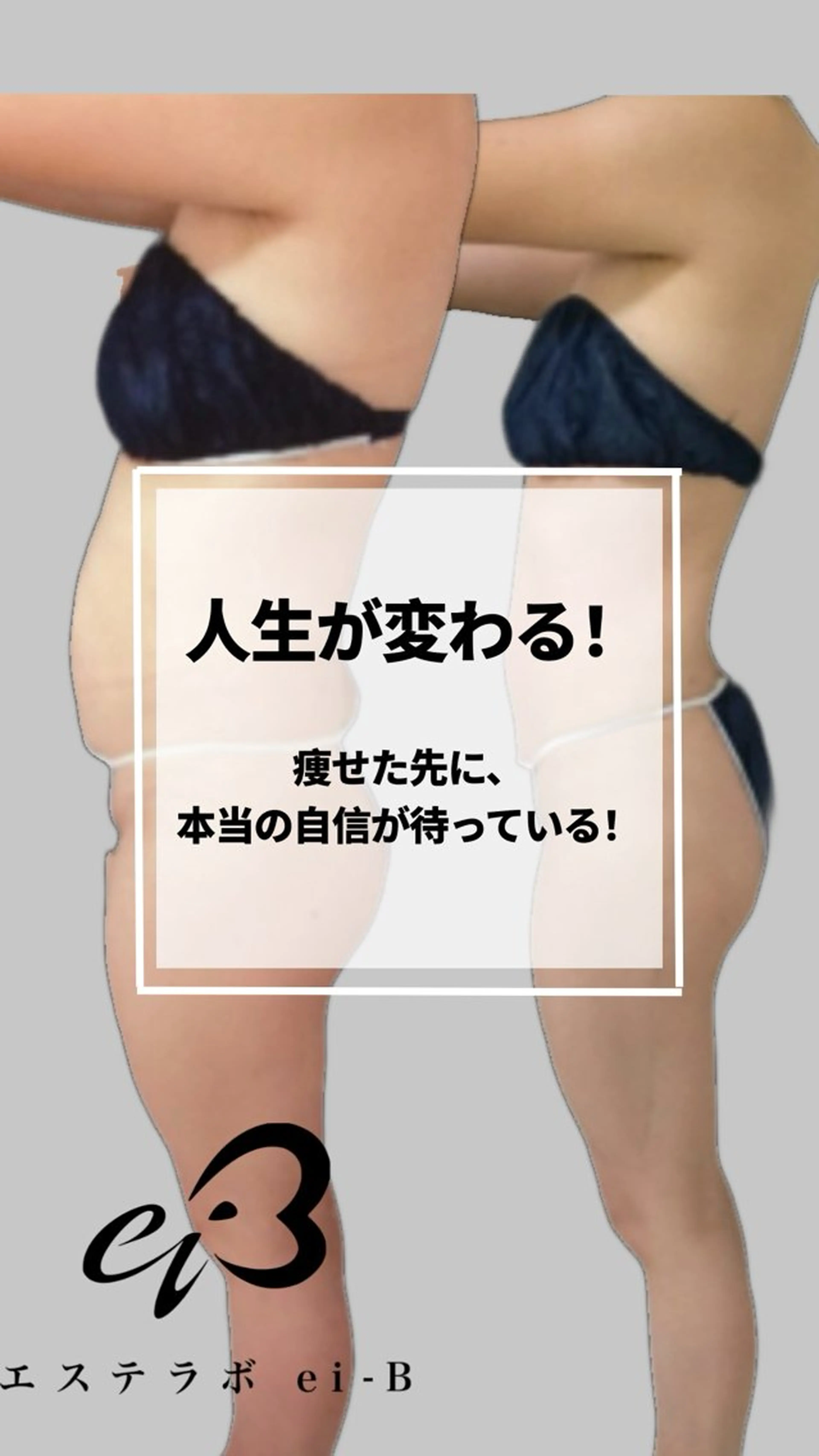 その他 ダイエット／脱毛 美顔／フォト／ハーブのその他イメージ