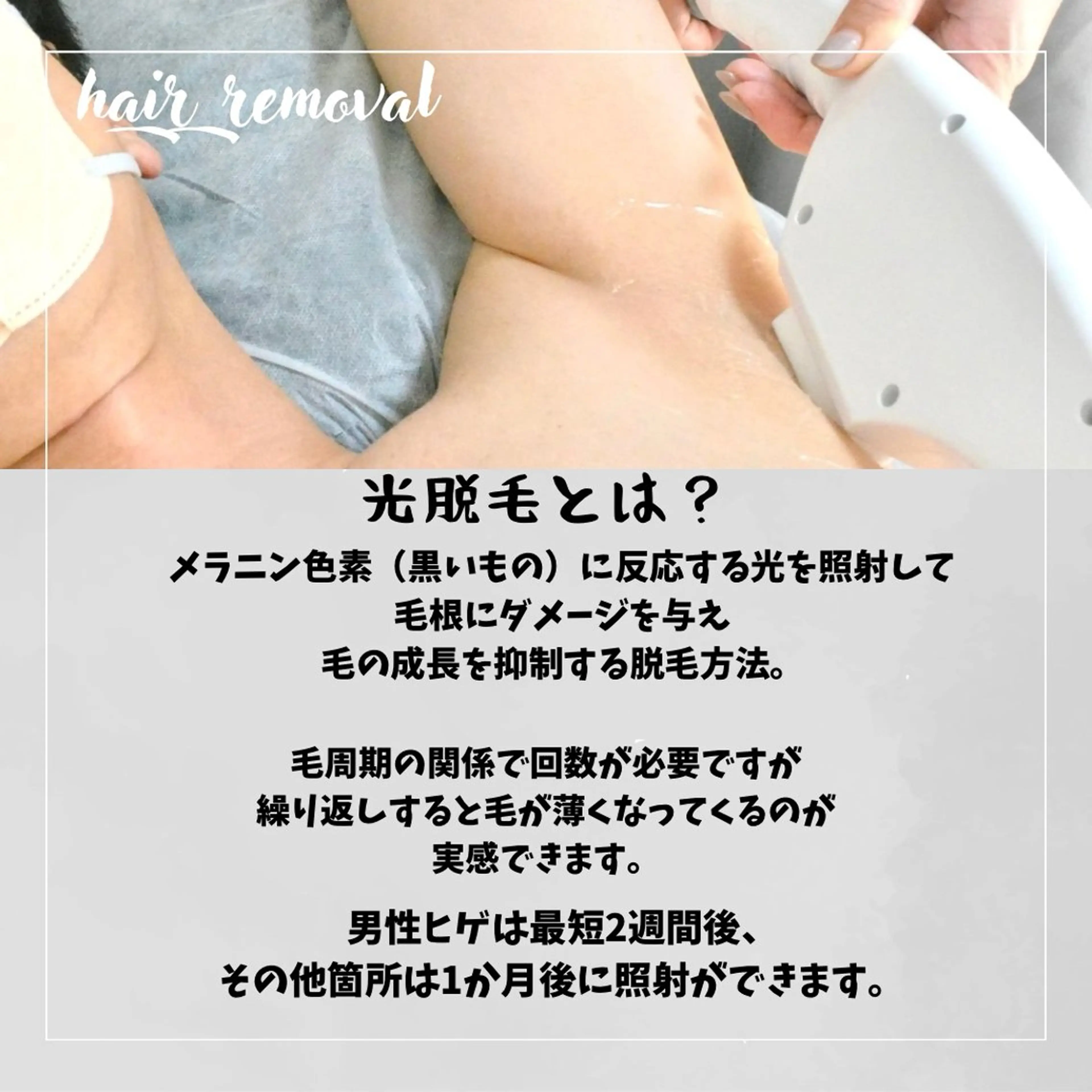 脱毛サロンMIRUDA所属・MIRUDA 林のエステ・リラクイメージ