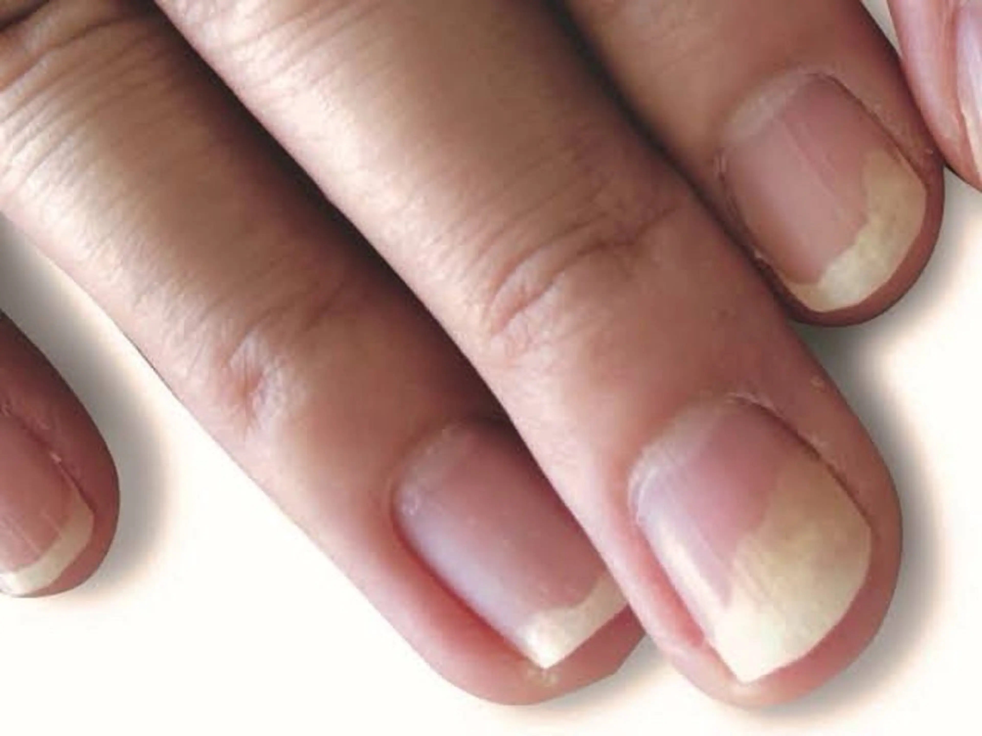 ネイル Cure.美爪育成 salon三輪のネイルデザイン