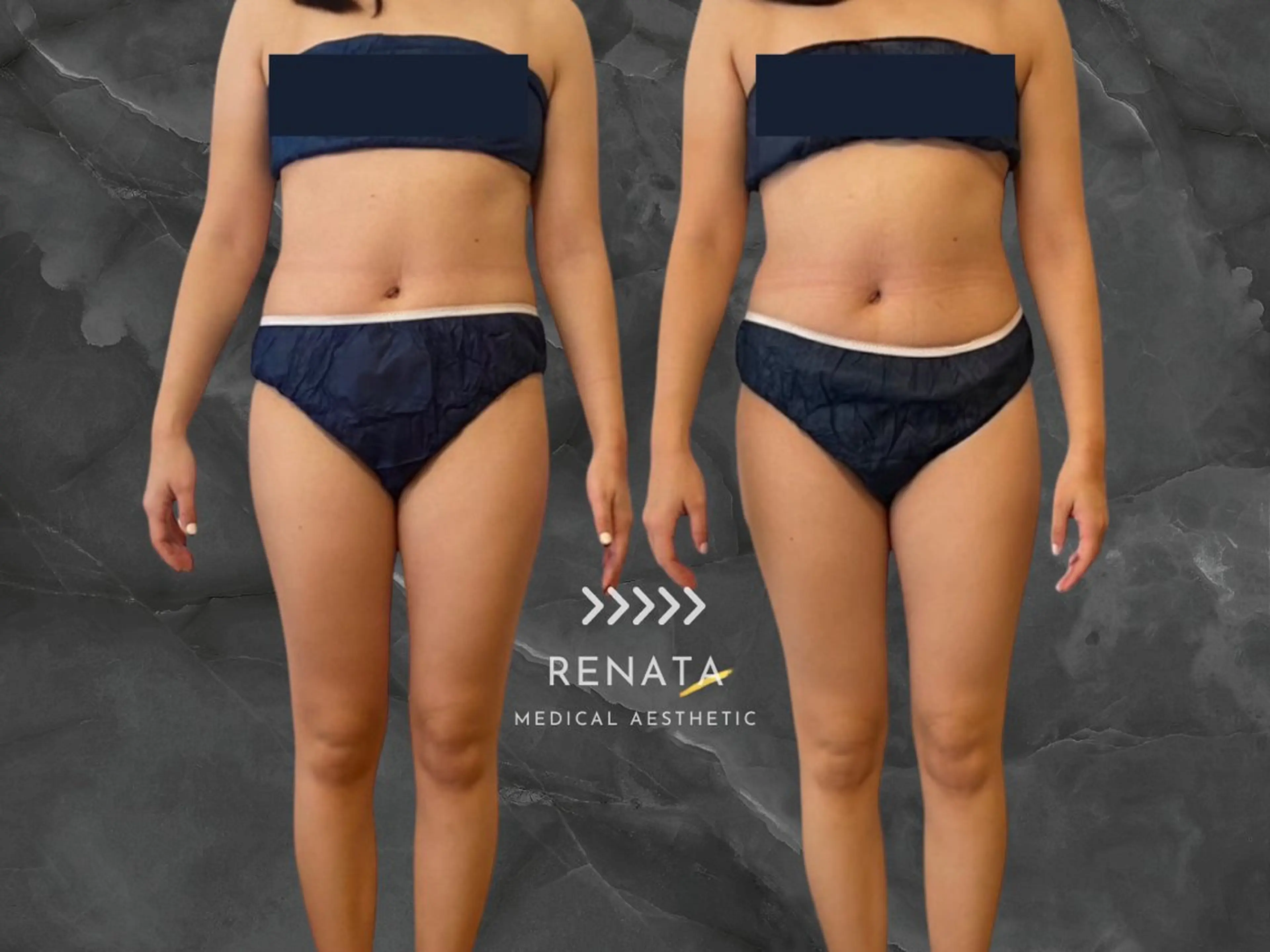 RENATA🕊 脂肪冷却専門店六本木のエステ・リラクイメージ