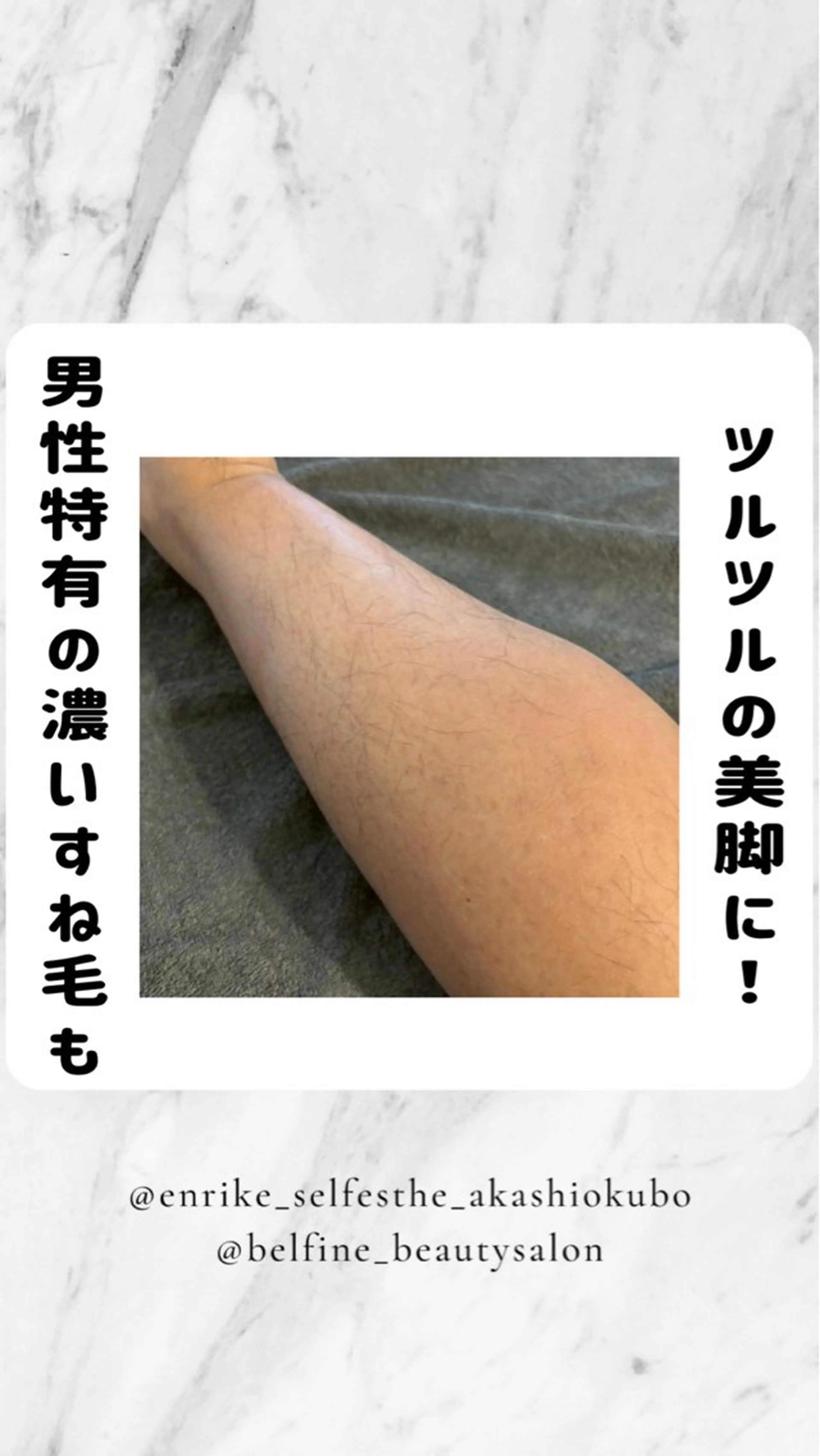 脱毛 セルフエステ エンリケ 明石大久保店所属・ほなみ リンパ&脱毛&痩身のエステ・リラクイメージ