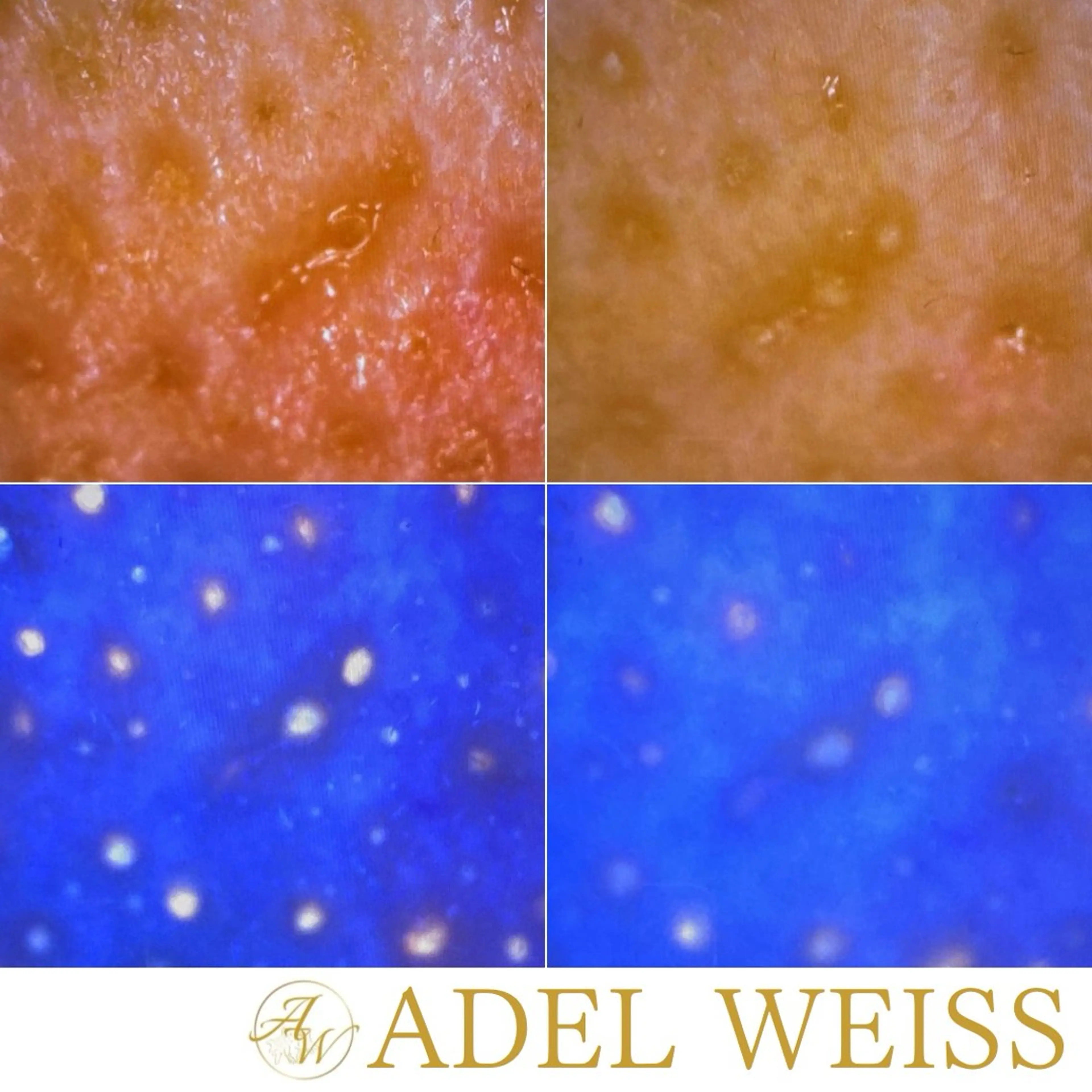 エステ 毛穴ケア＆脱毛サロン　ADEL WEISS所属・毛穴ケア＆脱毛サロン ADEL　WEISSのエステ・リラクイメージ