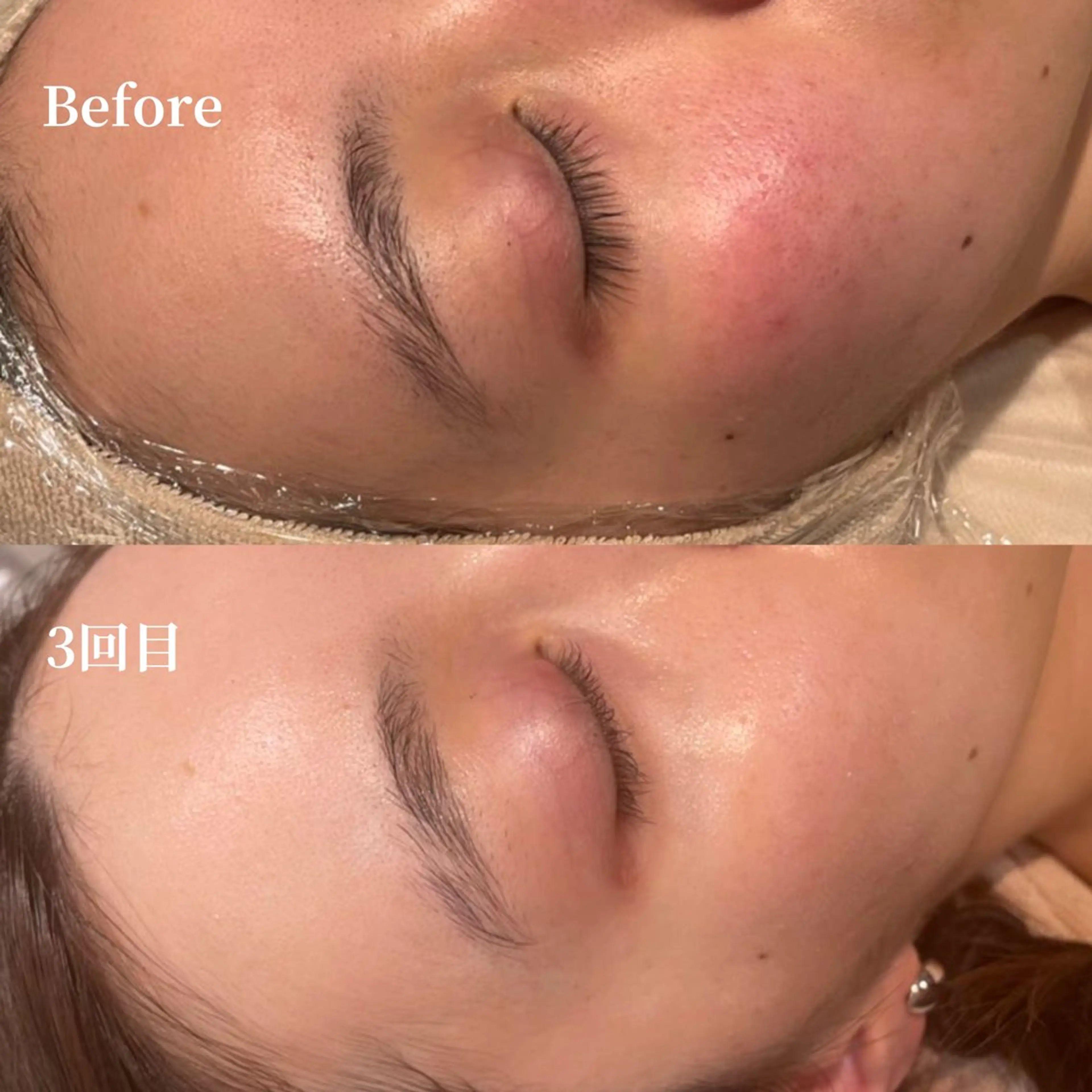 エステ /ulu  soin所属・太田 玲奈のエステ・リラクイメージ