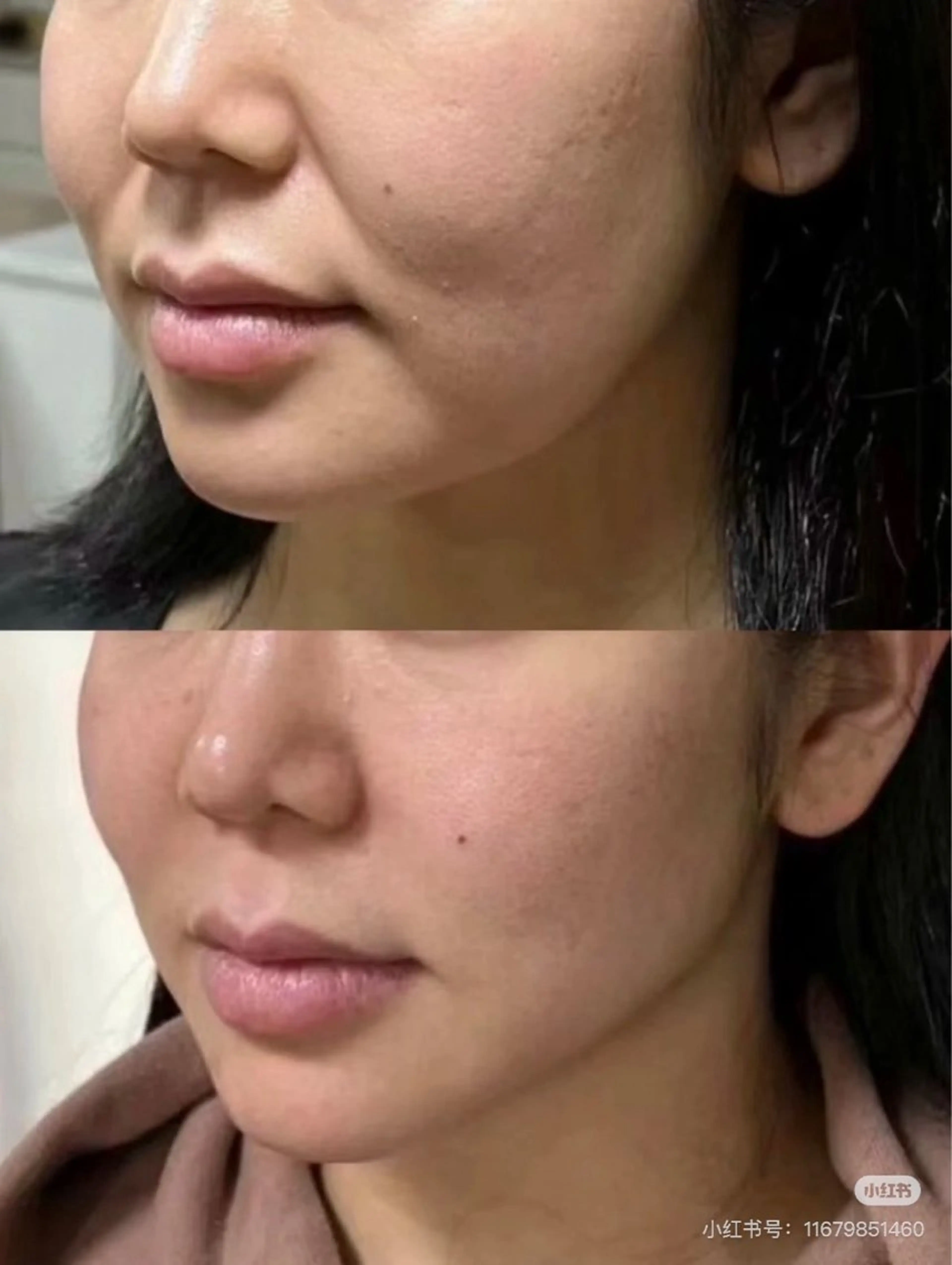 ネイル 韓国ネイル エステ aliaハイフ&水光ジェットサロン所属・aliaハーブ水光店 エステティシャン募集のエステ・リラクイメージ