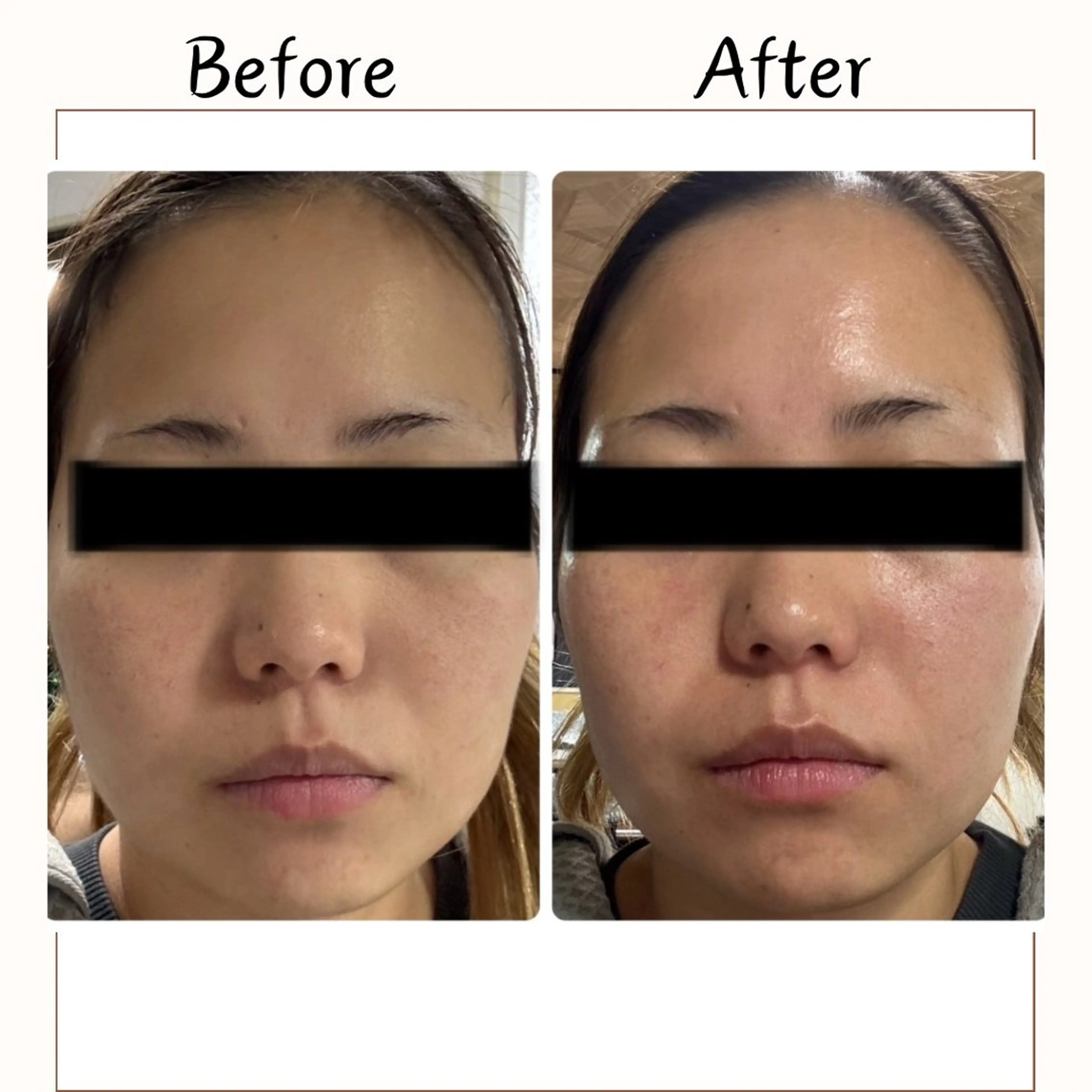 エステ Lulu estheticsalon所属・Lulu 　田村 梨乃のエステ・リラクイメージ